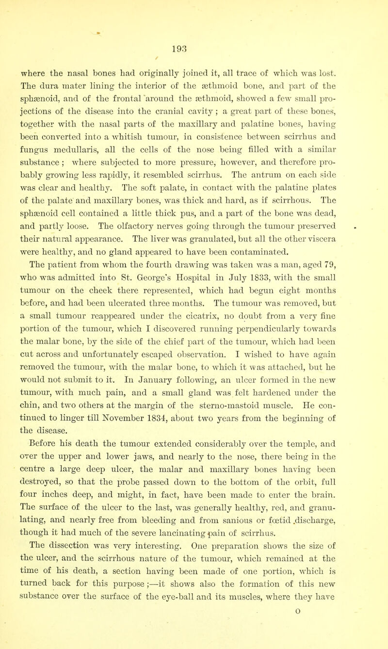 where the nasal bones had originally joined it, all trace of which was lost. The dura mater lining the interior of the gethmoid bone, and part of the sphasnoid, and of the frontal around the sethmoid, showed a few small pro- jections of the disease into the cranial cavity ; a great part of these bones, together with the nasal parts of the maxillary and palatine bones, having been converted into a whitish tumour, in consistence between scirrhus and fungus medullaris, all the cells of the nose being filled with a similar substance ; where subjected to more pressure, however, and therefore pro- bably growing less rapidly, it resembled scirrhus. The antrum on each side was clear and healthy. The soft palate, in contact with the palatine plates of the palate and maxillary bones, was thick and hard, as if scirrhous. The sphsenoid cell contained a little thick pus, and a part of the bone was dead, and partly loose. The olfactory nerves going through the tumour preserved their natural appearance. The liver was granulated, but all the other viscera were healthy, and no gland appeared to have been contaminated. The patient from whom the fourth drawing was taken was a man, aged 79, who was admitted into St. George's Hospital in July 1833, with the small tumour on the cheek there represented, which had begun eight months before, and had been ulcerated three months. The tumour was removed, but a small tumour reappeared under the cicatrix, no doubt from a very fine portion of the tumour, which I discovered running perpendicularly towards the malar bone, by the side of the chief part of the tumour, which had been cut across and unfortunately escaped observation. I wished to have again removed the tumour, with the malar bone, to which it was attached, but he would not submit to it. In January following, an ulcer formed in the new tumour, with much pain, and a small gland was felt hardened under the chin, and two others at the margin of the sterno-mastoid muscle. He con- tinued to linger till November 1834, about two years from the beginning of the disease. Before his death the tumour extended considerably over the temple, and over the upper and lower jaws, and nearly to the nose, there being in the centre a large deep ulcer, the malar and maxillary bones having been destroyed, so that the probe passed down to the bottom of the orbit, full four inches deep, and might, in fact, have been made to enter the brain. The surface of the ulcer to the last, was generally healthy, red, and granu- lating, and nearly free from bleeding and from sanious or foetid .discharge, though it had much of the severe lancinating pain of scirrhus. The dissection was very interesting. One preparation shows the size of the ulcer, and the scirrhous nature of the tumour, which remained at the time of his death, a section having been made of one portion, which is turned back for this purpose ;—it shows also the formation of this new substance over the surface of the eye-ball and its muscles, where they have 0