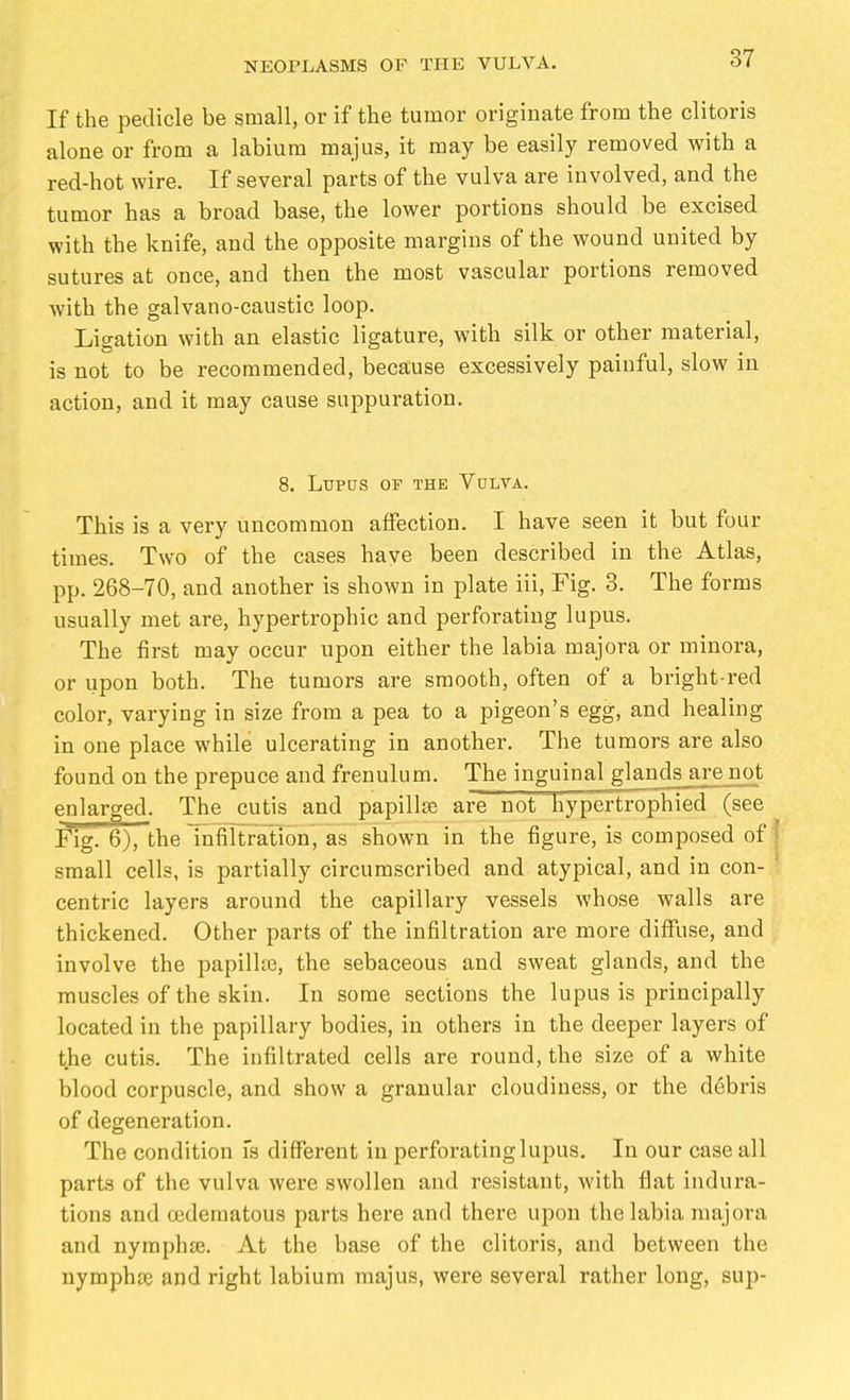 If the pedicle be small, or if the tumor originate from the clitoris alone or from a labium majus, it may be easily removed with a red-hot wire. If several parts of the vulva are involved, and the tumor has a broad base, the lower portions should be excised with the knife, and the opposite margins of the wound united by sutures at once, and then the most vascular portions removed with the galvano-caustic loop. Ligation with an elastic ligature, with silk or other material, is not to be recommended, because excessively painful, slow in action, and it may cause suppuration. 8. Lupus of the Vulta. This is a very uncommon affection. I have seen it but four times. Two of the cases have been described in the Atlas, pp. 268-70, and another is shown in plate iii. Fig. 3. The forms usually met are, hypertrophic and perforating lupus. The first may occur upon either the labia majora or minora, or upon both. The tumors are smooth, often of a bright-red color, varying in size from a pea to a pigeon's egg, and healing in one place while ulcerating in another. The tumors are also found on the prepuce and frenulum. The inguinal glands are not enlarged. The cutis and papillae are not hypertrophied (see Fig. 6), the InfiltraUon, as shown in the figure, is composed of small cells, is partially circumscribed and atypical, and in con- centric layers around the capillary vessels whose walls are thickened. Other parts of the infiltration are more diffuse, and involve the papilke, the sebaceous and sweat glands, and the muscles of the skin. In some sections the lupus is principally located in the papillary bodies, in others in the deeper layers of the cutis. The infiltrated cells are round, the size of a white blood corpuscle, and show a granular cloudiness, or the debris of degeneration. The condition fs different in perforating lupus. In our case all parts of the vulva were swollen and resistant, with flat indura- tions and (edematous parts here and there upon the labia majora and nymphse. At the base of the clitoris, and between the nymphsc and right labium majus, were several rather long, sup-