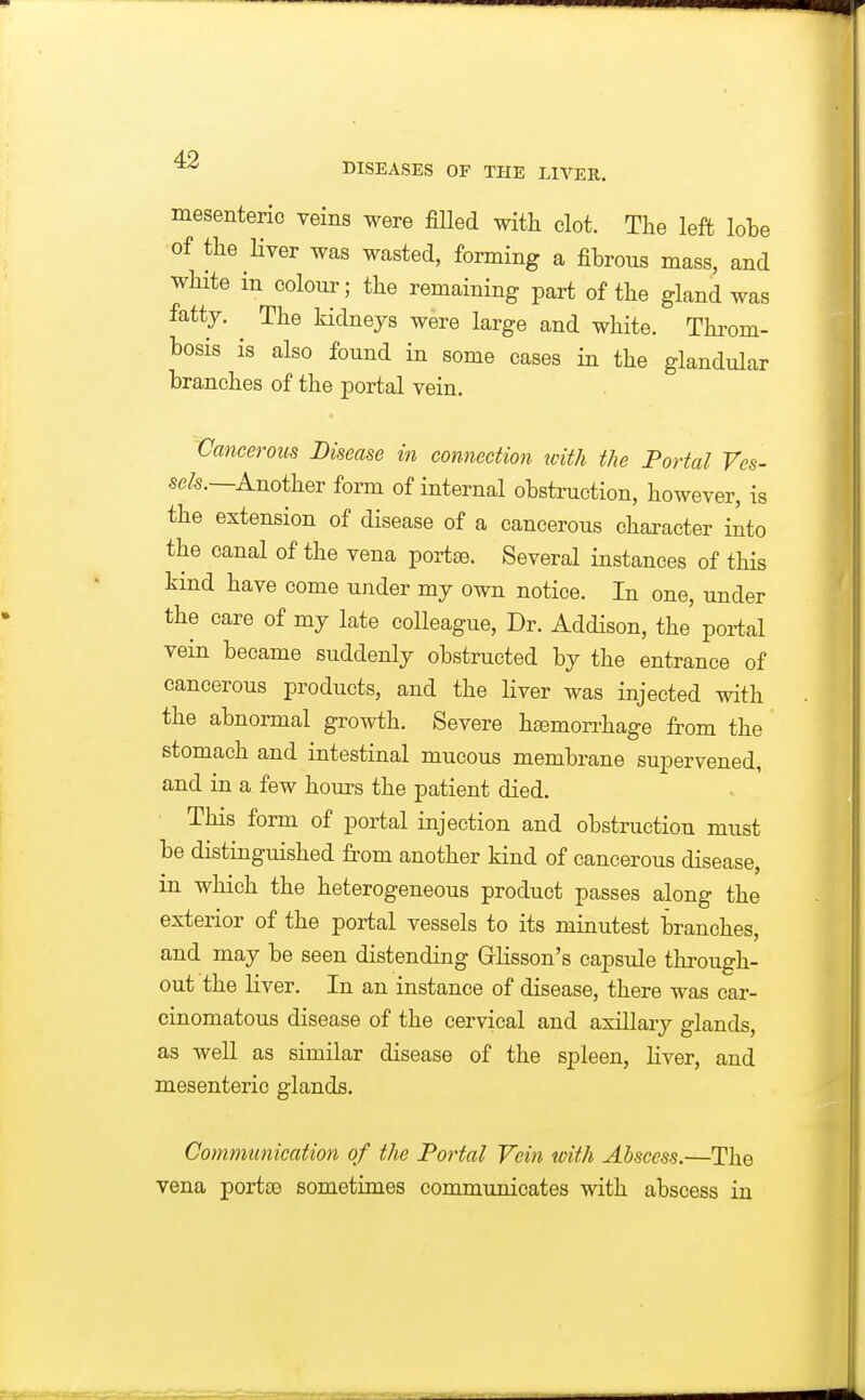 mesenteric veins were filled with clot. The left lobe of the Hver was wasted, forming a fibrous mass, and white in colour; the remaining jDart of the gland was fatty. ^ The kidneys were large and white. Thi-om- bosis is also found in some cases in the glandular branches of the portal vein. Cancerous Disease in connection icith the Portal Ves- sels.—Another form of internal obstruction, however, is the extension of disease of a cancerous character into the canal of the vena portse. Several instances of this kind have come under my own notice. In one, under the care of my late colleague. Dr. Addison, the' portal vein became suddenly obstructed by the entrance of cancerous products, and the liver was injected with the abnormal growth. Severe h£emorrhage from the stomach and intestinal mucous membrane supervened, and in a few hours the patient died. • This form of portal injection and obstruction must be distinguished fi'om another kind of cancerous disease, in which the heterogeneous product passes along the exterior of the portal vessels to its minutest branches, and may be seen distending Grlisson's capsule through- out the liver. In an instance of disease, there was car- cinomatous disease of the cervical and axillaiy glands, as well as similar disease of the spleen, liver, and mesenteric glands. Communication of the Portal Vein with Abscess.—The vena portse sometimes communicates with abscess in