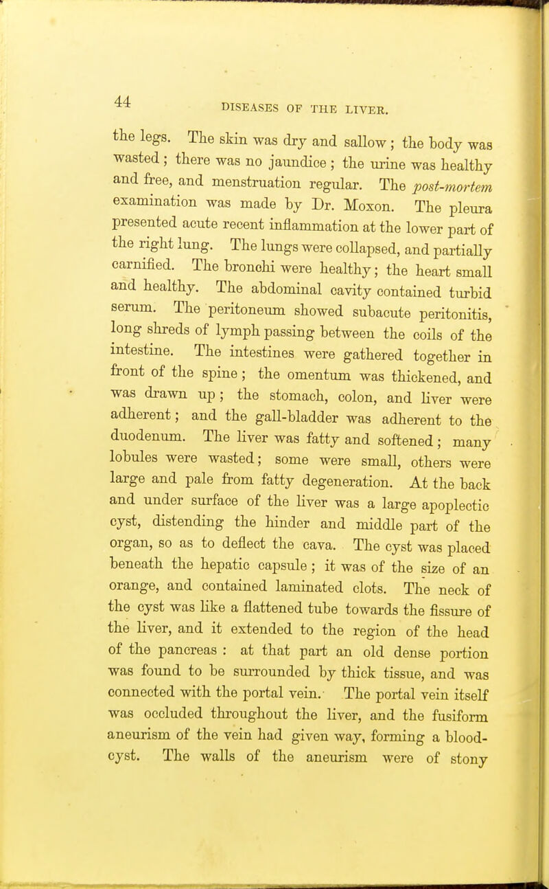 the legs. The skin was dry and sallow ; the body was wasted ; there was no jaundice ; the urine was healthy and free, and menstruation regular. The post-mortem examination was made by Dr. Moxon. The pleura presented acute recent inflammation at the lower part of the right lung. The lungs were coUapsed, and partially carnified. The bronchi were healthy; the heart small and healthy. The abdominal cavity contained turbid serum. The peritoneum showed subacute peritonitis, long shreds of lymph passing between the coils of the intestine. The intestines were gathered together in front of the spine ; the omentum was thickened, and was drawn up ; the stomach, colon, and liver were adherent; and the gall-bladder was adherent to the duodenum. The Hver was fatty and softened ; many lobules were wasted; some were small, others were large and pale from fatty degeneration. At the back and under surface of the liver was a large apoplectic cyst, distending the hinder and middle part of the organ, so as to deflect the cava. The cyst was placed beneath the hepatic capsule; it was of the size of an orange, and contained laminated clots. The neck of the cyst was Kke a flattened tube towards the fissure of the liver, and it extended to the region of the head of the pancreas : at that part an old dense portion was found to be surrounded by thick tissue, and was connected with the portal vein.- The portal vein itself was occluded throughout the liver, and the fusiform aneurism of the vein had given way, forming a blood- cyst. The walls of the aneurism were of stony