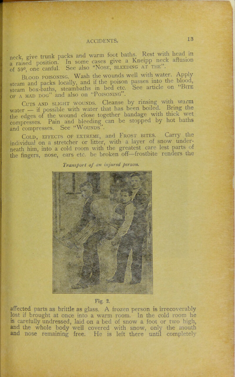 neck give trunk packs and warm foot baths Rest with head in a raised position. In some cases give a Kneipp neck aftusion of 590 one canful. See also Nose, bleeding at the . Blood poisoning. Wash the wounds well with water. Apply steam and packs locally, and if the poison passes into the blood, steam box-baths, steambaths in bed etc. See article on Bite OF A MAD dog and also on Poisoning. Cuts AND slight wounds. Cleanse by rinsing with wafm water — if possible with water that has been boiled. Bring the the edges of the wound close together bandage with thick wet compresses. Pain and bleeding^ can be stopped by hot baths and compresses. See Wounds. Cold, effects of extreme, and Frost bites. Carr}- the individual on a stretcher or litter, with a layer of snow under- neath him, into a cold room with the greatest care lest parts of the fingers, nose, ears etc. be broken off—frostbite renders the Transport 0/ an injured person. Fig. 2. afTected parts as brittle as glass. A frozen person is irrecoverably lost if brought at once into a warm room. In the cold room he is carefully undressed, laid on a bed of snow a foot or two high, and the whole body well covered with snow, only the mouth and nose remaining free. He is left there until completely