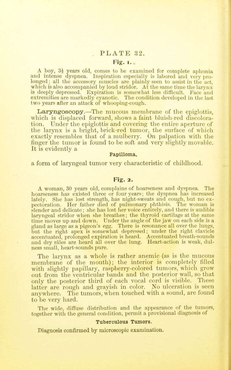 Fig. I. A boy, 3i years old, comes to be examined for complete aphonia and intense dyspnea. Inspiration especially is labored and very j)ro- longed; all the access<jry nmscles are plainly seen to assist in tlie act, which is also accompanied by loud stridor. At the same time the larynx is deeply depressed. Expiration is somewhat le.ss difficult. Face and extremities are markedly cyanotic. The condition developed in the last two years after an attack of whooping-cough. Laryngoscopy.—The mucous membrane of the epiglottis, which is displaced forward, shows a faint blui.sh-red discolora- tion. Under the epiglottis and covering the entire aperture of the larynx is a bright, brick-red tumor, tlie surface of which exactly resembles that of a mulberry. On palpation with the finger the tumor is found to be soft and very sHghtly movable. It is evidently a Papilloma, a form of laryngeal tumor very characteristic of childhood. Fig. 2. A woman, 30 years old, complains of hoarseness and dy.spnea. The hoarseness has existed three or four years; the dyspnea has increased lately. She lias lost strength, has night-sweats and cough, but no ex- pectoration. Her father died of pulmonary phthisis. Tlie woman is slender and delicate; she has lost her voice entirely, and there is audible laryngeal stridor when she breathes; the thyroid cartilage at the same time moves up and down. Under the angle of the jaw on each side is a gland as large as a pigeon's egg. There is resonance all over the lungs, but the right apex is somewhat depressed; under the right clavicle accentuated, prolonged expiration is heard. Accentuated breath-sounds and dry rales are heard all over the lung. Heart-action is weak, dul- ness small, heart-sounds pure. The larynx as a whole is rather anemic (as is the mucous membrane of the mouth); the interior is completely filled with slightly papillary, raspberry-colored tumors, which grow out from the ventricular bands and the posterior wall, so that only the posterior third of each vocal cord is visible. These latter are rough and grayish in color. No ulceration is seen anywhere. The tumors, when touched with a sound, are found to be very hard. The wide, diffuse distribution and the appearance of the tumors, together with the general condition, permit a provisional diagnosis of Tuberculous Tumors. Diagnosis confirmed by microscopic examination.