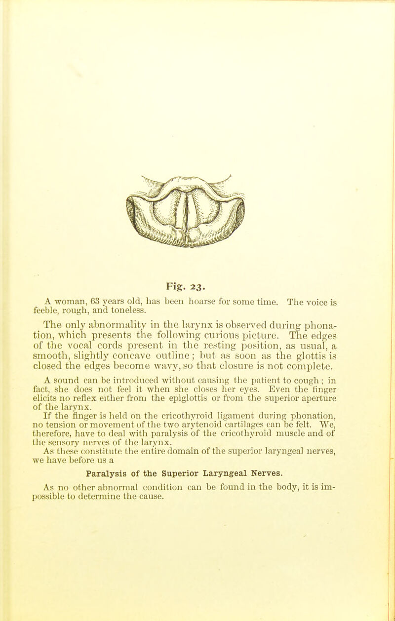 A woman, 63 years old, has been hoarse for some time. The voice is feeble, rough, and toneless. The Olli}' abnormality in the larynx is observed during Phona- tion, which presents the following curious picture. The edges of the vocal cords present in the resting position, as usual, a smooth, slightly concave outline; but as soon as the glottis is closed the edges become wavy, so that closure is not complete. A sound can be introduced without causing the patient to cough ; in fact, she does not feel it when she closes her eyes. Even the linger elicits no reflex either from the epiglottis or from the superior aperture of the larynx. If the finger is held on the cricothyroid ligament during phonation, no tension or movement of tlie two arytenoid cartilages can be felt. We, therefore, have to deal with paralysis of the cricothyroid muscle and of the sensory nerves of the larynx. As these constitute the entire domain of the superior laryngeal nerves, we have before us a Paralysis of the Superior Laryngeal Nerves. As no other abnormal condition can be found in the body, it is im- possible to determine the cause.