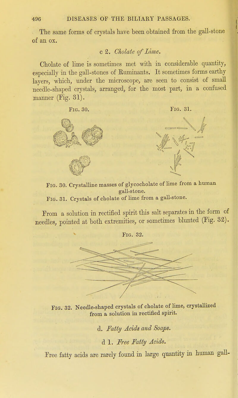 The same forms of crystals have been obtained from the gall-stone of an ox. c 2. Cholate of Lime. Cholate of lime is sometimes met with in considerable quantity, especially in the gall-stones of Euminants. It sometimes forms earthy layers, which, under the microscope, are seen to consist of small needle-shaped crystals, arranged, for the most part, in a confused manner (Kg. 31). Fig. 30. Fig. 31. ft Fig. 30. Crystalline masses of glycocholate of lime from a human gall-stone. Fig. 31. Crystals of cholate of lime from a gall-stone. Erom a solution in rectified spirit this salt separates in the form of needles, pointed at both extremities, or sometimes blunted (Eg. 32). Fig. 32. Fig. 32. Needle-shaped crystals of cholate of lime, crystallized from a solution in rectified spirit. d. Fatty Acids and Soaps. d 1. Free Fatty Acids. Free fatty acids are rarely found in large quantity in human gall-