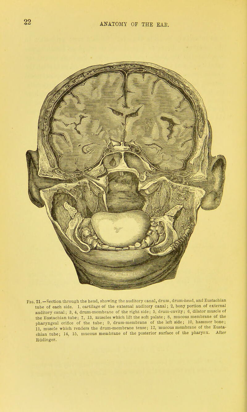 Fio. 21.—Section throuRh the head, showing the auditory lanal, drum, drum-head, and Eustachian tube of each side. 1. cartilajfe or the external auditory canal; 2, bony portion of external auditory canal; 3, 4, drum-mombrane of the right side; 5, drum-cavity; 6, dilator muscle of the Eustachian tube; 7, 13, muscles which lift the soft palate; 8, mucous membrane of the pharyngeal orifice of the tube; 9, drum-merabrano of the left side; 10, hammer bone; 11, muscle which renders the drum-membrane tense; 12, mucous membrane of the Eusta- chian tube; 14, 15, mucous membrane of the posterior surface of the pharynx. After Kudlrger.