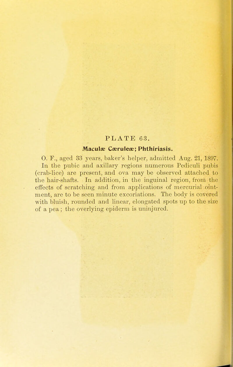 Maculae Caerulea;; Phthiriasis. 0. F., aged 33 years, baker's helper, admitted Aug. 21, 1897. In the pubic and axillary regions numerous Pediculi pubis (crab-lice) are present, and ova may be observed attached to the hair-shafts. In addition, in the inguinal region, from the effects of scratching and from applications of mercurial oint- ment, are to be seen minute excoriations. The body is covered with bluish, rounded and linear, elongated spots up to the size of a pea; the overlying epiderm is uninjured.