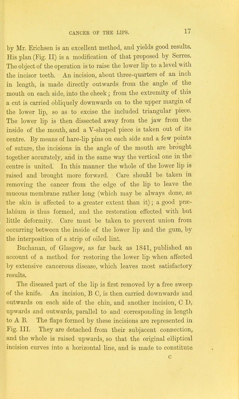 by Mr. Erichsen is an excellent method, and yields good results. His plan (Fig. II) is a modification of that proposed by Serres. The object of the operation is to raise the lower Hp to a level with the incisor teeth. An incision, about three-quarters of an inch in length, is made directly outwards from the angle of the mouth on each side, into the cheek; from the extremity of this a cut is carried obliquely downwards on to the upper margin of the lower Hp, so as to excise the included triangular piece. The lower Hp is then dissected away from the jaw from the inside of the mouth, and a V-shaped piece is taken out of its centre. By means of hare-Hp pins on each side and a few points of suture, the incisions in the angle of the mouth are brought together accurately, and in the same way the vertical one in the centre is united. In this manner the whole of the lower Hp is raised and brought more forward. Care should be taken in removing the cancer from the edge of the Hp to leave the mucous membrane rather long (which may be always done, as the skin is affected to a greater extent than it); a good pra3- labium is thus formed, and the restoration effected with but little deformity. Care must be taken to prevent union from occurring between the inside of the lower lip and the gum, by the interposition of a strip of oiled lint. Buchanan, of Glasgow, as far back as 1841, pubHshed an account of a method for restoring the lower Hp when affected by extensive cancerous disease, which leaves most satisfactory results. The diseased part of the Hp is first removed by a free sweep of the knife. An incision, B C, is then carried downwards and outwards on each side of the chin, and another incision, C D, upwards and outwards, parallel to and corresponding in length to A B. The flaps formed by these incisions are represented in Fig. III. They are detached from their subjacent connection, and the whole is raised upwards, so that the original elHptical incision curves into a horizontal line, and is made to constitute C