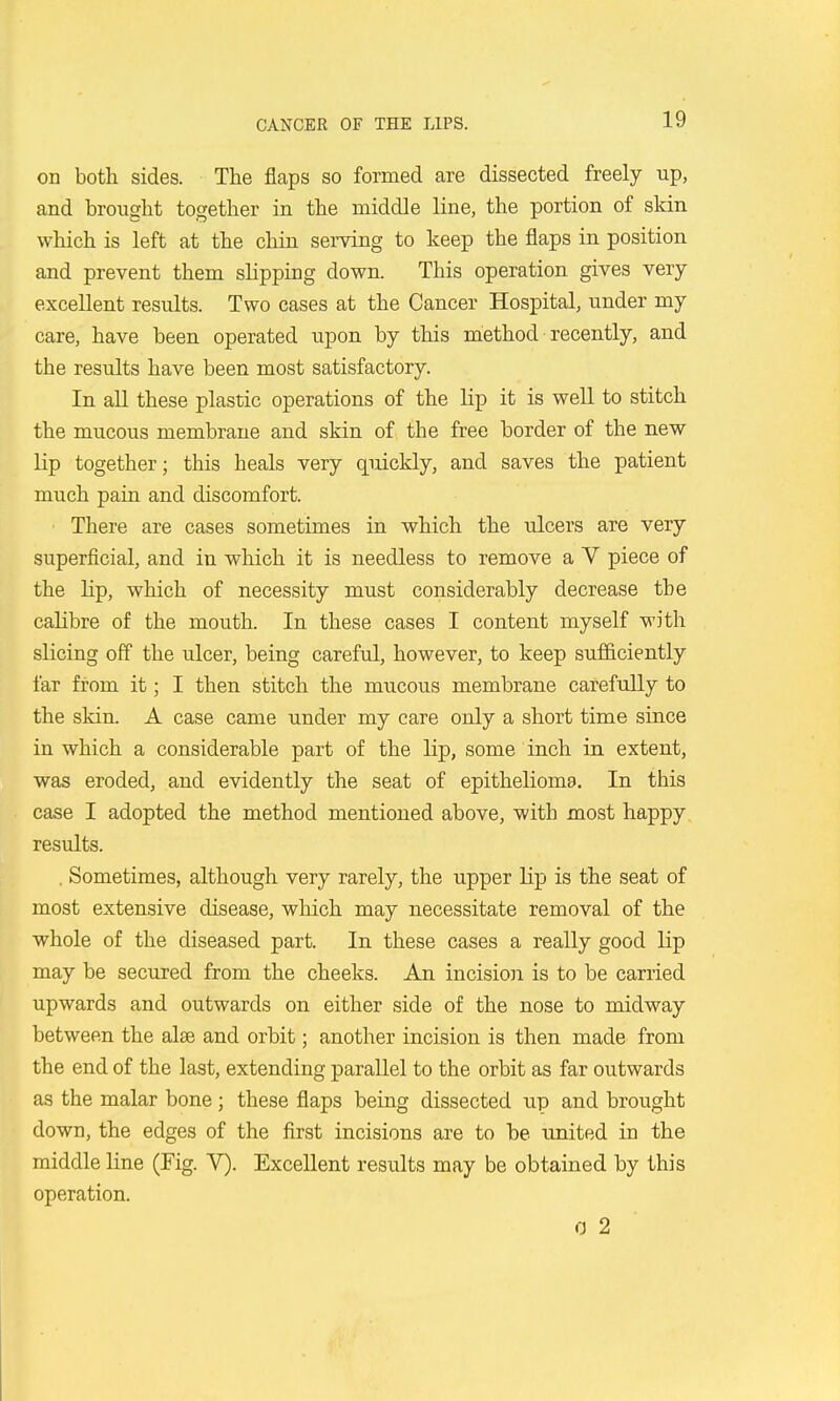 on both sides. The flaps so formed are dissected freely up, and brought together in the middle line, the portion of skin which is left at the chin serving to keep the flaps in position and prevent them slipping down. This operation gives very- excellent results. Two cases at the Cancer Hospital, under my care, have been operated upon by this method recently, and the results have been most satisfactory. In all these plastic operations of the lip it is well to stitch the mucous membrane and skin of the free border of the new lip together; this heals very quickly, and saves the patient much pain and discomfort. There are cases sometimes in which the ulcers are very superficial, and in which it is needless to remove a V piece of the lip, which of necessity must considerably decrease the calibre of the mouth. In these cases I content myself with slicing off the ulcer, being careful, however, to keep sufficiently far from it; I then stitch the mucous membrane carefuUy to the skin. A case came under my care only a short time since in which a considerable part of the lip, some inch in extent, was eroded, and evidently the seat of epithelioma. In this case I adopted the method mentioned above, with most happy results. , Sometimes, although very rarely, the upper lip is the seat of most extensive disease, which may necessitate removal of the whole of the diseased part. In these cases a really good lip may be secured from the cheeks. An incisioii is to be carried upwards and outwards on either side of the nose to midway between the alee and orbit; another incision is then made from the end of the last, extending parallel to the orbit as far outwards as the malar bone; these flaps being dissected up and brought down, the edges of the first incisions are to be united in the middle line (Fig. V). Excellent results may be obtained by this operation. 0 2
