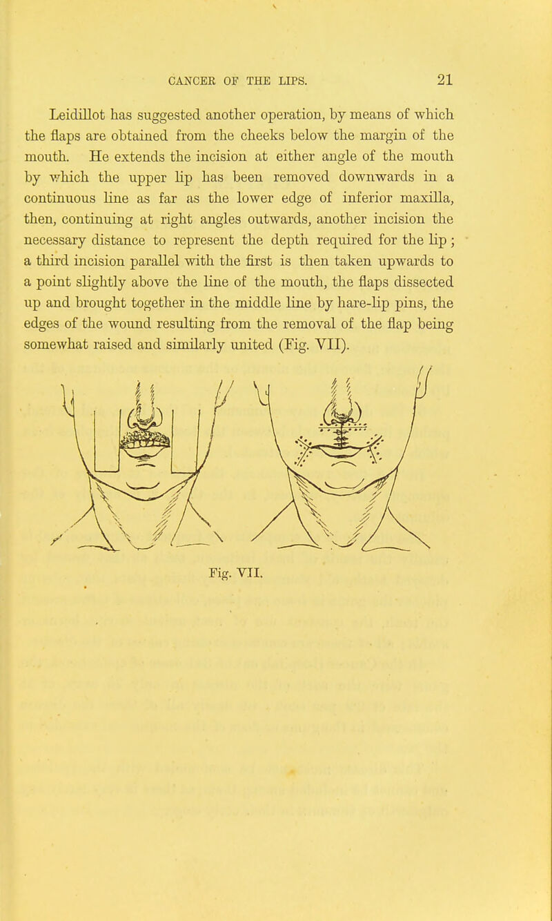 Leidillot has suggested another operation, by means of which the flaps are obtained from the cheeks below the margin of the mouth. He extends the incision at either angle of the mouth by which the upper lip has been removed downwards in a continuous line as far as the lower edge of inferior maxilla, then, continuing at right angles outwards, another incision the necessary distance to represent the depth required for the lip; a third incision parallel with the first is then taken upwards to a point slightly above the line of the mouth, the flaps dissected up and brought together in the middle line by hare-lip pins, the edges of the wound resulting from the removal of the flap being somewhat raised and similarly united (Fig. VII).