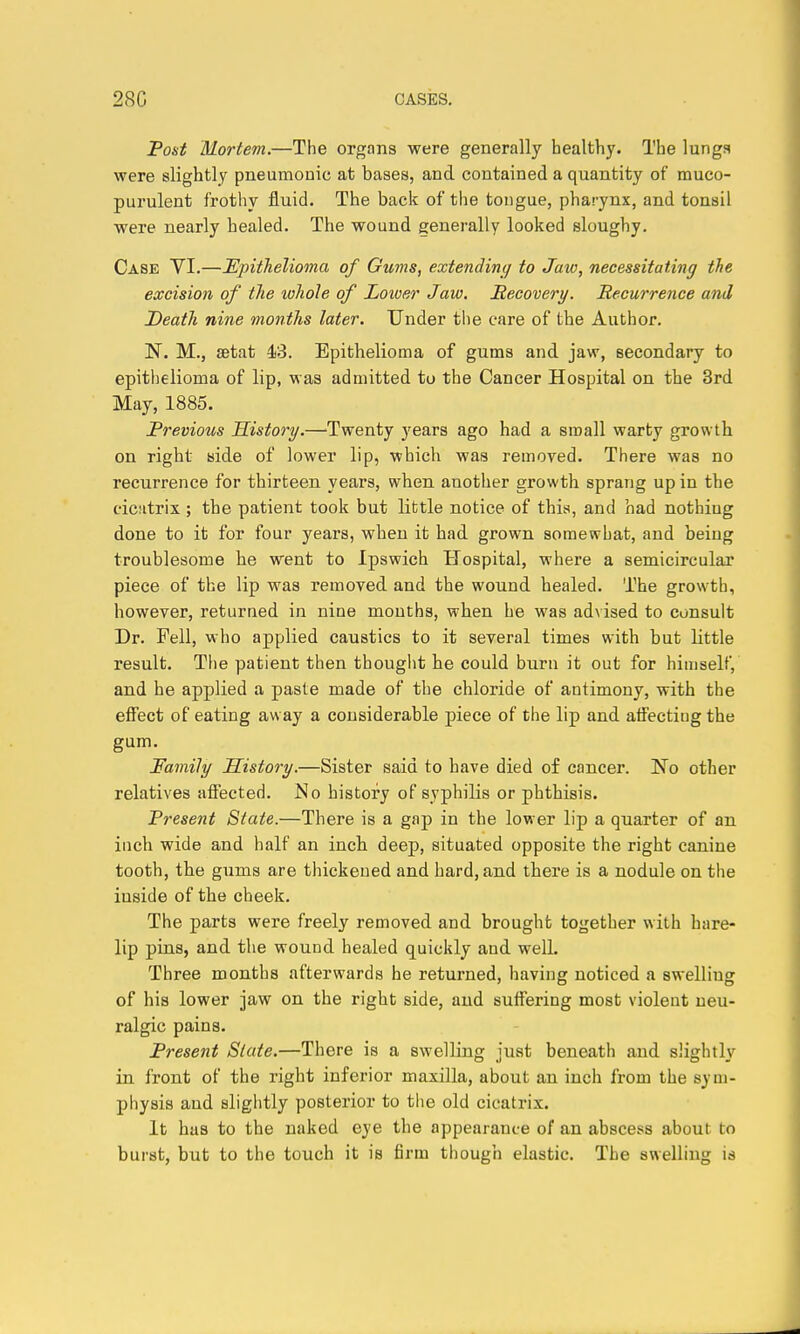 Post Mortem.—The organs were generally healthy. The lunga were slightly pneumonic at bases, and contained a quantity of muco- purulent frothy fluid. The back of the tongue, pharynx, and tonsil were nearly healed. The wound generally looked sloughy. Case YI.—Epithelioma of Gums, extendini] to Jaw, necessitating the excision of the whole of Loioer Jaw. Recovery. Recurrence and Death nine months later. Under the care of the Author. ]Sr. M., setat 43. Epithelioma of gums and jaw, secondary to epithelioma of lip, was admitted to the Cancer Hospital on the 3rd May, 1885. Previous History.—Twenty years ago had a small warty growth on right side of lower lip, which was removed. There was no recurrence for thirteen years, when another growth sprang up in the cicsitrix ; the patient took but little notice of this, and had nothiug done to it for four years, when it had grown somewhat, and being troublesome he went to Ipswich Hospital, where a semicircular piece of the lip was removed and the wound healed. The growth, however, returned in nine mouths, when he was advised to consult Dr. Fell, who applied caustics to it several times with but little result. The patient then thought he could burn it out for himself, and he applied a paste made of the chloride of antimony, with the effect of eating away a considerable piece of the lip and aff'ecting the gum. Family History.—Sister said to have died of cancer. No other relatives affected. No history of syphilis or phthisis. Present State.—There is a gap in the lower lip a quarter of an inch wide and half an inch deep, situated opposite the right canine tooth, the gums are thickened and hard, and there is a nodule on the inside of the cheek. The parts were freely removed and brought together with hare- lip pins, and the wound healed quickly and well. Three months afterwards he returned, having noticed a swelling of his lower jaw on the right side, and suffering most violent neu- ralgic pains. Present Slate.—There is a swelling just beneath and slightly in front of the right inferior maxilla, about an inch from the sym- physis and sliglitly posterior to the old cicatrix. It has to the naked eye the appearance of an abscess about to burst, but to the touch it is firm though elastic. The swelling ia