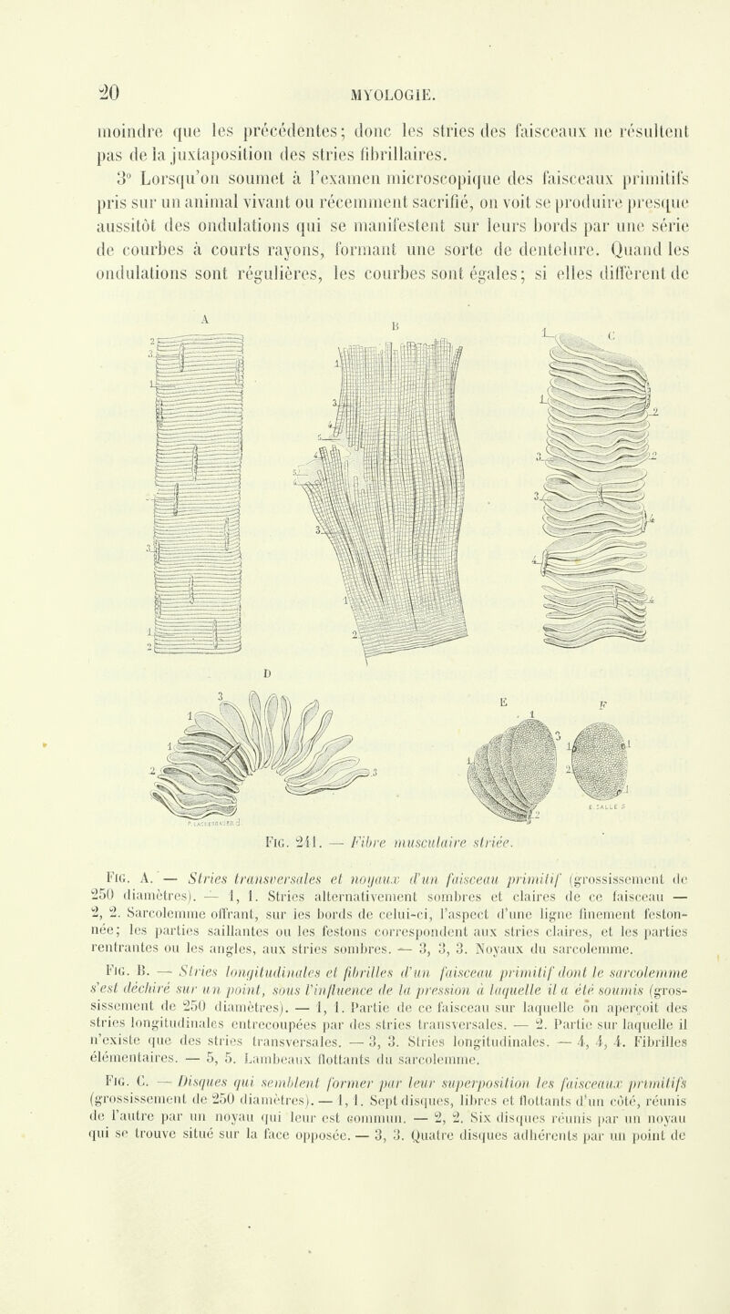 moindre que les précédentes; donc les stries des faisceaux ne résultent pas de la juxtaposition des stries fibrillaires. 3° Lorsqu’on soumet à l’examen microscopique des faisceaux primitifs pris sur un animal vivant ou récemment sacrifié, on voit se produire presque aussitôt des ondulations qui se manifestent sur leurs bords par une série de courbes à courts rayons, formant une sorte de dentelure. Quand les ondulations sont régulières, les courbes sont égales ; si elles diffèrent de Fig. 241. — Fibre musculaire striée. Fig. A. — Stries transversales et noyaux d’un faisceau primitif (grossissement de 250 diamètres). — 1, 1. Stries alternativement sombres et claires de ce faisceau — 2, 2. Sarcolemme offrant, sur les bords de celui-ci, l’aspect d’une ligne finement feston¬ née; les parties saillantes ou les festons correspondent aux stries claires, et les parties rentrantes ou les angles, aux stries sombres. — 3, 3, 3. Noyaux du sarcolemme. Fjg. B. —■ Stries longitudinales et fibrilles d'un faisceau primitif dont le sarcolemme s’est déchiré sur un point, sous l'influence de la pression à laquelle il a été soumis (gros¬ sissement de 250 diamètres). — 1,1. Partie de ce faisceau sur laquelle ôn aperçoit des stries longitudinales entrecoupées par des stries transversales. — 2. Partie sur laquelle il n’existe que des stries transversales. — 3, 3. Stries longitudinales. — 4, 4, 4. Fibrilles élémentaires. — 5, 5. Lambeaux flottants du sarcolemme. Fig. C. — Disques qui semblent former par leur superposition les faisceaux primitifs (grossissement de 250 diamètres).— 1,1. Sept disques, libres et flottants d’un coté, réunis de l’autre par un noyau qui leur est commun. — 2, 2. Six disques réunis par un noyau qui se trouve situé sur la face opposée. — 3, 3. Quatre disques adhérents par un point de