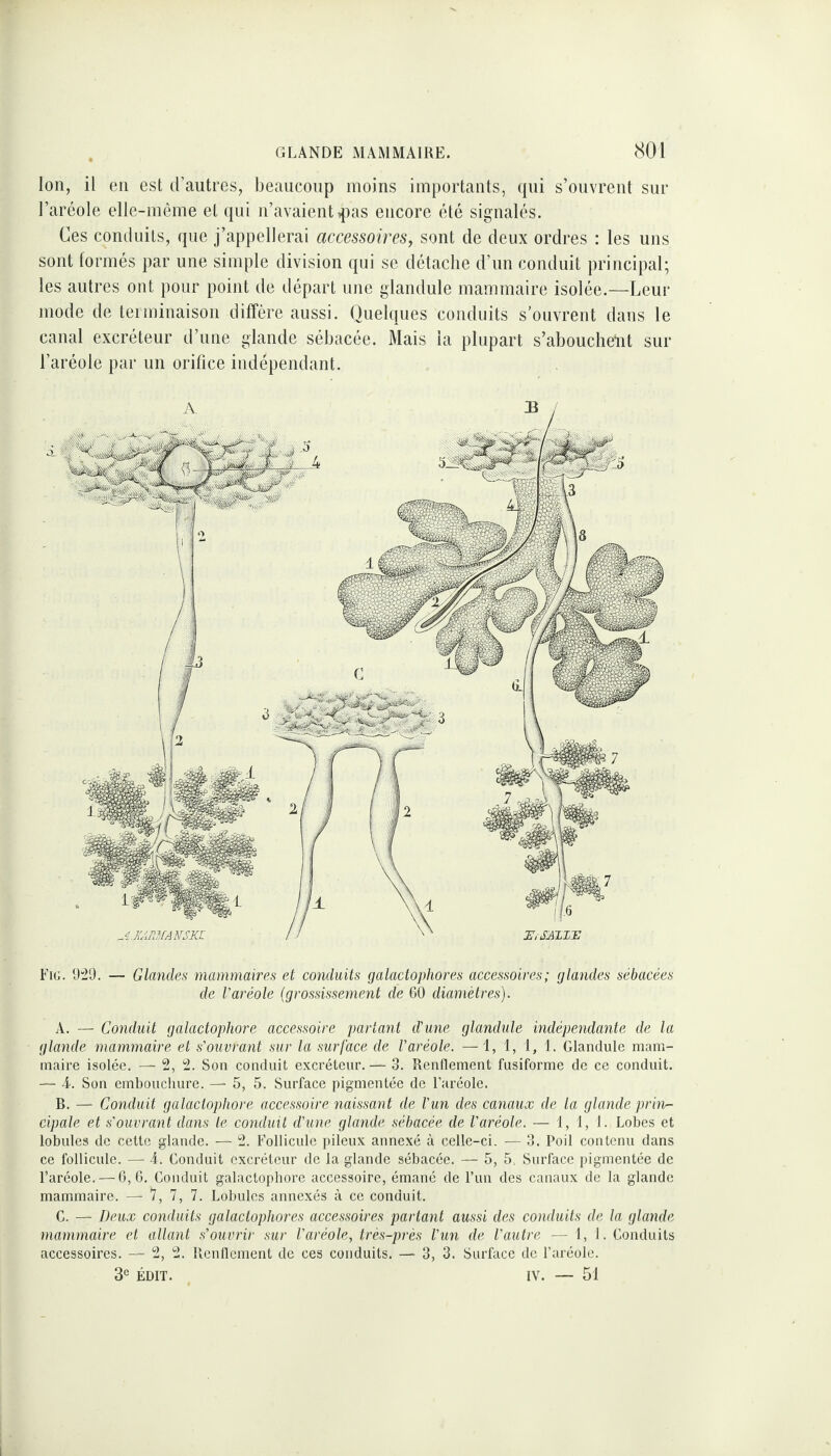 Ion, il en est d’autres, beaucoup moins importants, qui s’ouvrent sur l’aréole elle-même et qui n’avaient ,pas encore été signalés. Ces conduits, que j’appellerai accessoires, sont de deux ordres : les uns sont formés par une simple division qui se détache d’un conduit principal; les autres ont pour point de départ une glandule mammaire isolée.—Leur mode de terminaison diffère aussi. Quelques conduits s’ouvrent dans le canal excréteur d’une glande sébacée. Mais la plupart s’abouchent sur l’aréole par un orifice indépendant. Fig. 929. — Glandes mammaires et conduits galactophores accessoires; glandes sébacées de l'aréole (grossissement de 60 diamètres). A. — Conduit galadophore accessoire partant d'une glandule indépendante de la glande mammaire et s'ouvrant sur la surface de l'aréole. — 1, 1, 1, 1. Glandule mam¬ maire isolée. — 2, 2. Son conduit excréteur. — 3. Renflement fusiforme de ce conduit. — A. Son embouchure. — 5, 5. Surface pigmentée de l’aréole. B. — Conduit galadophore accessoire naissant de l'un des canaux de la glande prin- cipale et s'ouvrant dans le conduit d'une glande sébacée de l'aréole. — 1, 1, 1. Lobes et lobules de cette glande. — 2. Follicule pileux annexé à celle-ci. — 3. Poil contenu dans ce follicule. — 4. Conduit excréteur de la glande sébacée. — 5, 5. Surface pigmentée de l’aréole. — 6,6. Conduit galactophore accessoire, émané de l’un des canaux de la glande mammaire. —- 7, 7, 7. Lobules annexés à ce conduit. C. — Deux conduits galactophores accessoires partant aussi des conduits de la glande mammaire et allant s'ouvrir sur l'aréole, très-près l'un de l'autre — 1, 1. Conduits accessoires. — 2, 2. Renflement de ces conduits. — 3, 3. Surface de l’aréole. 3e ÉDIT. IV. — 51