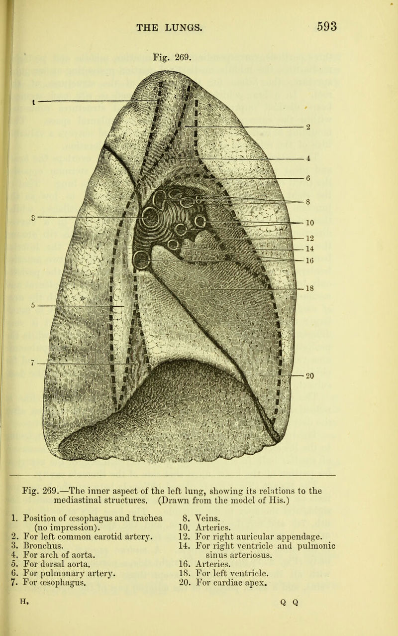 Fig. 269. Fig. 269.—The inner aspect of the left lung, showing its relations to the mediastinal structures. (Drawn from the model of His.) 1. Position of oesophagus and trachea (no impression). 2. For left common carotid arter}'. 3. Bronchus. 4. For arch of aorta. 5. For dorsal aorta. 6. For pulmonary artery. 7. For oesophagus. 8. Veins. 10. Arteries. 12. For right auricular appendage. 14. For right ventricle and pulmonic sinus arteriosus. 16. Arteries. 15. For left ventricle. 20. For cardiac apex. H. Q Q
