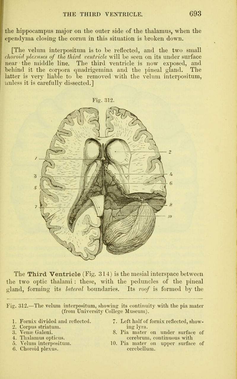 tlie hippocampus major on the outer side of the thalamus, when the ^^pendyma closing the cornu in this situation is broken down. [The velum interpositum is to be reflected, and the two small rlioroid jilexnses of the third ventricle will be seen on its under surface near the middle line. The third ventricle is now exposed, and behind it the corpora fjuadrigemina and the pineal gland. The latter is very liable to be removed with the velum interpositum, unless it is carefully dissected.] Fig. 312. The Third Ventricle (Fig. 314) is the mesial interspace between the two optic thalami: these, with the peduncles of the pineal gland, forming its lateral boundaries. Its roof is formed by the Fig. 312.—The velum interpositum, showing its contiiuiity with the pia mater (from University College Museum). 1. Fornix divided and reflected. 2. Corpus striatum. 3. Venue Galeni. 4. Thalamus opticus. 5. Velum interpositum. 6. Choroid plexus. 7. Left half of fornix reflected, show- ing lyra. 8. Pia mater on under surface of cerebrum, continuous with 10. Pia mater on upper surface of cerebellum.