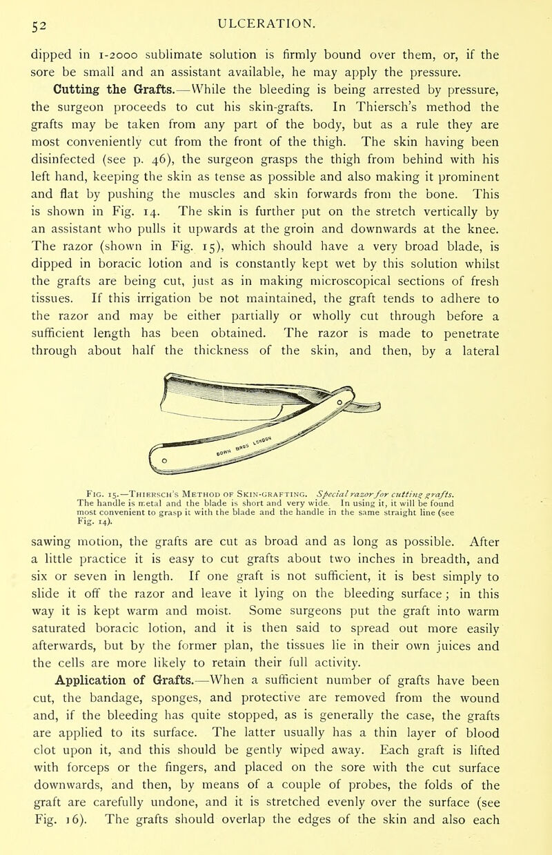 5^ dipped in 1-2000 sublimate solution is firmly bound over them, or, if the sore be small and an assistant available, he may apply the pressure. Cutting the Grafts.—While the bleeding is being arrested by pressure, the surgeon proceeds to cut his skin-grafts. In Thiersch's method the grafts may be taken from any part of the body, but as a rule they are most conveniently cut from the front of the thigh. The skin having been disinfected (see p. 46), the surgeon grasps the thigh from behind with his left hand, keeping the skin as tense as possible and also making it prominent and flat by pushing the muscles and skin forwards from the bone. This is shown in Fig. 14. The skin is further put on the stretch vertically by an assistant who pulls it upwards at the groin and downwards at the knee. The razor (shown in Fig. 15), which should have a very broad blade, is dipped in boracic lotion and is constantly kept wet by this solution whilst the grafts are being cut, just as in making microscopical sections of fresh tissues. If this irrigation be not maintained, the graft tends to adhere to the razor and may be either partially or wholly cut through before a sufficient length has been obtained. The razor is made to penetrate through about half the thickness of the skin, and then, by a lateral Fig. 15.—Thiersch's Method of Skin-grafting. Special razor for cutting grafts. The handle is metal and the blade is short and very wide. In using it, it will be found most convenient to grasp it with the blade and the handle in the same straight line (see Fig. 14). sawing motion, the grafts are cut as broad and as long as possible. After a little practice it is easy to cut grafts about two inches in breadth, and six or seven in length. If one graft is not sufficient, it is best simply to slide it off the razor and leave it lying on the bleeding surface; in this way it is kept warm and moist. Some surgeons put the graft into warm saturated boracic lotion, and it is then said to spread out more easily afterwards, but by the former plan, the tissues lie in their own juices and the cells are more likely to retain their full activity. Application of Grafts.—When a sufficient number of grafts have been cut, the bandage, sponges, and protective are removed from the wound and, if the bleeding has quite stopped, as is generally the case, the grafts are applied to its surface. The latter usually has a thin layer of blood clot upon it, -and this should be gently wiped away. Each graft is lifted with forceps or the fingers, and placed on the sore with the cut surface downwards, and then, by means of a couple of probes, the folds of the graft are carefully undone, and it is stretched evenly over the surface (see