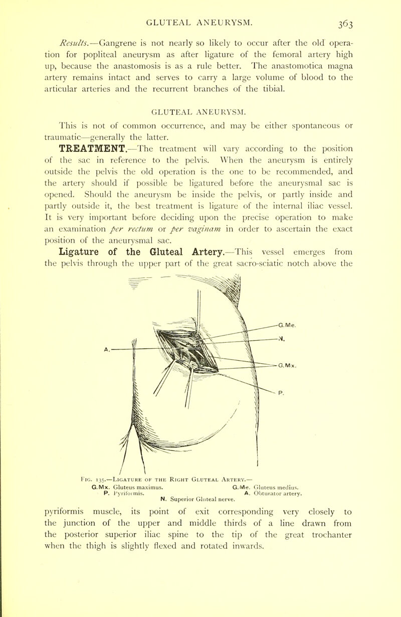 Results.—Gangrene is not nearly so likely to occur after the old opera- tion for popliteal aneurysm as after ligature of the femoral artery high up, because the anastomosis is as a rule better. The anastomotica magna artery remains intact and serves to carry a large volume of blood to the articular arteries and the recurrent branches of the tibial. GLUTEAL ANEURYSM. This is not of common occurrence, and may be either spontaneous or traumatic—generally the latter. TREATMENT.—The treatment will vary according to the position of the sac in reference to the pelvis. When the aneurysm is entirely outside the pelvis the old operation is the one to be recommended, and the artery should if possible be ligatured before the aneurysmal sac is opened. Should the aneurysm be inside the pelvis, or partly inside and partly outside it, the best treatment is ligature of the internal iliac vessel. It is very important before deciding upon the precise operation to make an examination per rectum or per vaginam in order to ascertain the exact position of the aneurysmal sac. Ligature of the Gluteal Artery.—This vessel emerges from the pelvis through the upper part of the great sacro-sciatic notch above the Fig. 135.—Ligature of the Right Gluteal Artery.— G.Mx. Gluteus maximus. G.Me. Gluteus medius. P. Pyriformis. A. Obturator artery. N. Superior Gluteal nerve. pyriformis muscle, its point of exit corresponding very closely to the junction of the upper and middle thirds of a line drawn from the posterior superior iliac spine to the tip of the great trochanter when the thigh is slightly flexed and rotated inwards.