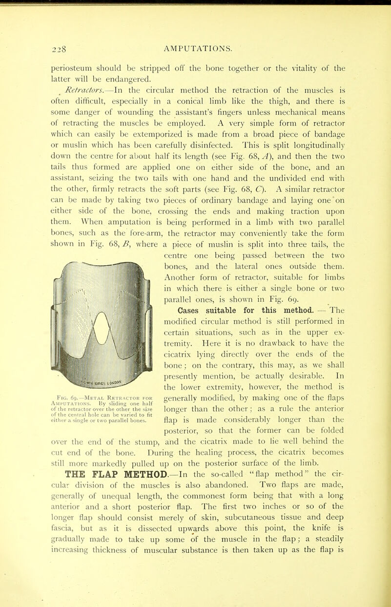 periosteum should be stripped off the bone together or the vitality of the latter will be endangered. Retractors.—In the circular method the retraction of the muscles is often difficult, especially in a conical limb like the thigh, and there is some danger of wounding the assistant's fingers unless mechanical means of retracting the muscles be employed. A very simple form of retractor which can easily be extemporized is made from a broad piece of bandage or muslin which has been carefully disinfected. This is split longitudinally down the centre for about half its length (see Fig. 68, A), and then the two tails thus formed are applied one on either side of the bone, and an assistant, seizing the two tails with one hand and the undivided end with the other, firmly retracts the soft parts (see Fig. 68, C). A similar retractor can be made by taking two pieces of ordinary bandage and laying one'on either side of the bone, crossing the ends and making traction upon them. When amputation is being performed in a limb with two parallel bones, such as the fore-arm, the retractor may conveniently take the form shown in Fig. 68, B, where a piece of muslin is split into three tails, the centre one being passed between the two bones, and the lateral ones outside them. Another form of retractor, suitable for limbs in which there is either a single bone or two parallel ones, is shown in Fig. 69. Cases suitable for this method. — The modified circular method is still performed in certain situations, such as in the upper ex- tremity. Here it is no drawback to have the cicatrix lying directly over the ends of the bone; on the contrary, this may, as we shall presently mention, be actually desirable. In the lower extremity, however, the method is Fig. 69.—Metal Retractor for generally modified, by making one of the flaps Amputations. By sliding one half . of the retractor over the other the size longer than the other; as a rule the anterior of the central hole can be varied to fit - • i i_i 1 1 1 either a single or two parallel bones. flap is made considerably longer than the posterior, so that the former can be folded over the end of the stump, and the cicatrix made to lie well behind the cut end of the bone. During the healing process, the cicatrix becomes still more markedly pulled up on the posterior surface of the limb. THE FLAP METHOD.—In the so-called flap method the cir- cular division of the muscles is also abandoned. Two flaps are made, generally of unequal length, the commonest form being that with a long anterior and a short posterior flap. The first two inches or so of the longer flap should consist merely of skin, subcutaneous tissue and deep fascia, but as it is dissected upwards above this point, the knife is gradually made to take up some of the muscle in the flap; a steadily increasing thickness of muscular substance is then taken up as the flap is