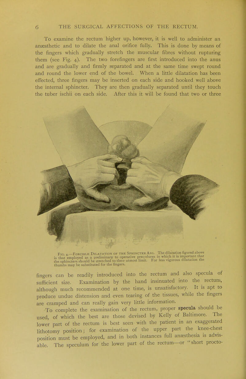 To examine the rectum higher up, however, it is well to administer an ansesthetic and to dilate the anal orifice fully. This is done by means of the fingers which gradually stretch the muscular fibres without rupturing them (see Fig. 4). The two forefingers are first introduced into the anus and are gradually and firmly separated and at the same time swept round and round the lower end of the bowel. When a little dilatation has been effected, three fingers may be inserted on each side and hooked well above the internal sphincter. They are then gradually separated until they touch the tuber ischii on each side. After this it will be found that two or three Fig 4 —Forcible Dilatation of the Sphincter Ani. The dilatation figured above is that employed as a preliminary to operative prec.:dures in which it is important that the sphincters should be stretched to the.r utmost limit. For less vigorous dilatation the thumbs may be substituted for the fingers. fingers can be readily introduced into the rectum and also specula of sufficient size. Examination by the hand insinuated into the rectum, although much recommended at one time, is unsatisfactory. It is apt to produce undue distension and even tearing of the tissues, while the fingers are cramped and can really gain very little information. To complete the examination of the rectum, proper specula should be used, of which the best are those devised by Kelly of Baltimore. The lower part of the rectum is best seen with the patient in an exaggerated lithotomy position; for examination of the upper part the knee-chest position must be employed, and in both instances full anaesthesia is advis- able The speculum for the lower part of the rectum-or short procto-