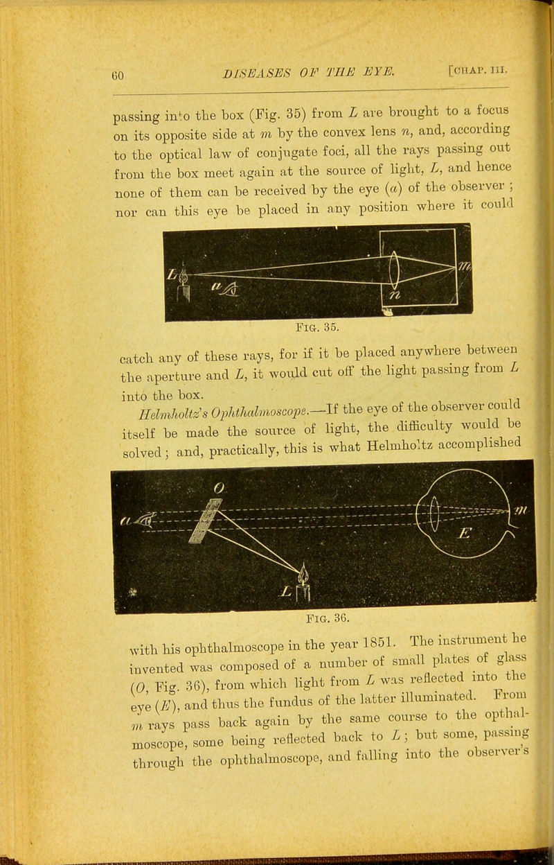 CO passing into the box (Fig. 35) from L are brought to a focus on its opposite side at m by the convex lens n, and, according to the optical law of conjugate foci, all the rays passing out from the box meet again at the source of light, L, and hence none of them can be received by the eye {a) of the observer ; nor can this eye be placed in any position where it could Fig. 35. catch any of these rays, for if it be placed anywhere between the aperture and L, it would cut off the light passing from L into the box. Hdviholtz's Ophtlmlmoscope.-li the eye of the observer could itself be made the source of light, the difficulty would be solved; and, practically, this is what Helmholtz accomplished Fig. 36. with his ophthalmoscope in the year 1851. The instmmen he invented was composed of a number of small plates of glass (0 Fig. 36), from which light from L was reflected into the eye (K), and thus the fundus of the latter illuminated. 1 rom ,u rays pass back agaia by the same course to the opthal- moscope'some being reflected back to L; but some passing through the ophthalmoscope, and falling into the observers