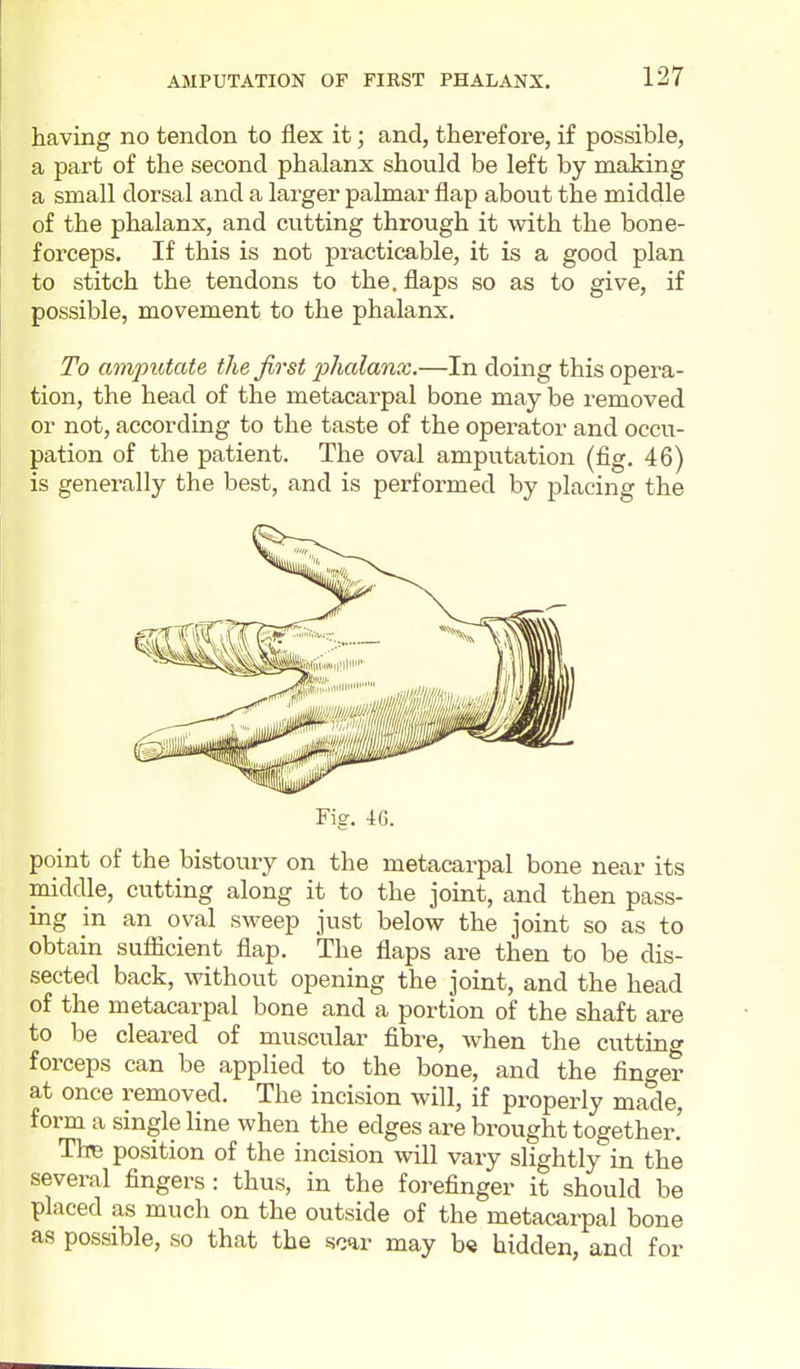 having no tendon to flex it; and, therefore, if possible, a part of the second phalanx should be left by making a small dorsal and a larger palmar flap about the middle of the phalanx, and cutting through it with the bone- forceps. If this is not practicable, it is a good plan to stitch the tendons to the. flaps so as to give, if possible, movement to the phalanx. To amputate the first phalanx.—In doing this opera- tion, the head of the metacarpal bone may be removed or not, according to the taste of the operator and occu- pation of the patient. The oval amputation (fig. 46) is generally the best, and is performed by placing the Fig. 46. point of the bistoury on the metacarpal bone near its middle, cutting along it to the joint, and then pass- ing in an oval sweep just below the joint so as to obtain sufficient flap. The flaps are then to be dis- sected back, without opening the joint, and the head of the metacarpal bone and a portion of the shaft are to be cleared of muscular fibre, when the cutting forceps can be applied to the bone, and the finger at once removed. The incision will, if properly made, form a single line when the edges are brought together.' The position of the incision wiU vary slightly in the several fingers: thus, in the forefinger it should be placed as much on the outside of the metacarpal bone as possible, so that the -scar may b« hidden, and for