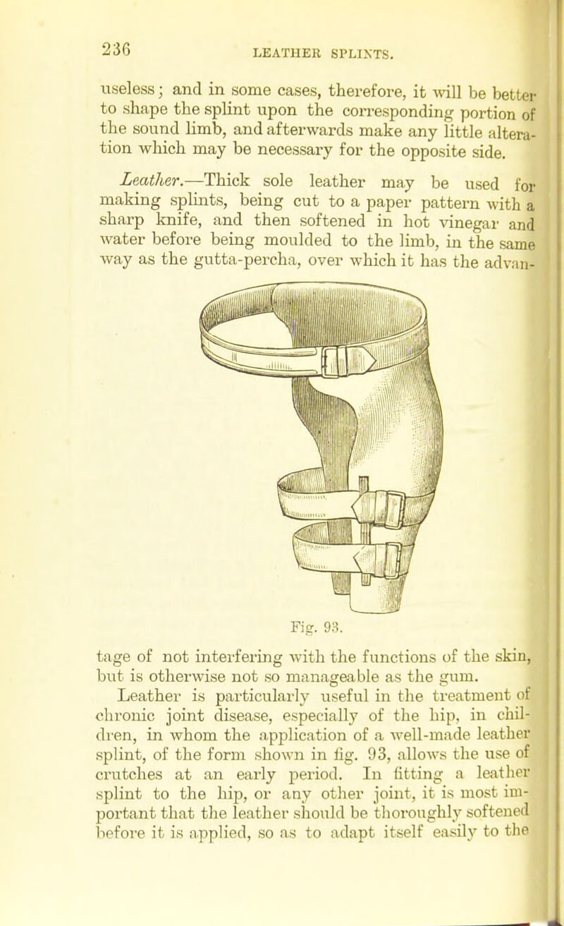 LEATHER SPLIXTS, useless; and in some cases, therefore, it will be better to shape the splint upon the corresponding portion of the sound limb, and afterwards make any little altera- tion which may be necessaiy for the opposite side. Leather—Thick sole leather may be used for making splints, being cut to a paper pattern with a sharp knife, and then softened in hot vinegar and water before being moulded to the limb, in the same way as the gutta-percha, over which it has the ad van- Fig. 93. tage of not interfering with the functions of the skin, but is otherwise not so manageable as the gum. Leather is particularly useful in the treatment of chronic joint disease, especially of the hip, in chil- dren, in whom the application of a well-made leather splint, of the form shown in fig. 93, allows the use of crutches at an early period. In fitting a leather splint to the hip, or any other joint, it is most im- portant that the leather should be thoroughly softened before it is applied, so as to adapt itself easily to the