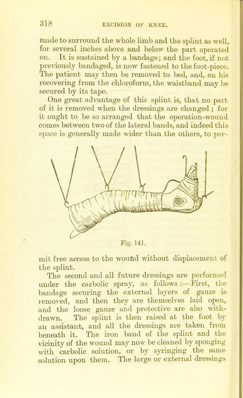 made to surround the whole limb and the splint as well, for several inches above and below the part operated on. It is sustained by a bandage; and the foot, if not previously bandaged, is now fastened to the foot-piece. The patient may then be removed to bed, and, on his recovering from the chloroform, the waistband may be secured by its tape. One great advantage of this splint is, that no pai-t of it is removed when the dressings are changed ; for it ought to be so arranged that the operation-wound comes between two of the lateral bands, and indeed this space is generally made wider than the others, to per- Fig. 141. mit free access to the woulld without displacement of the splint. The second and all future dressings are performed under the carbolic spray, as follows :—Fii'st, the bandage securing the external layers of gauze is I'emoved, and then they are themselves laid open, and the loose gauze and protective are also with- drawn. The splint is then raised at the foot by an assistant, and all the dressings are taken from beneath it. The iron band of the splint and the vicinity of the wound may now be cleaned by sponging with carbolic solution, or by syringing the same solution upon them. The large or external dressing!*
