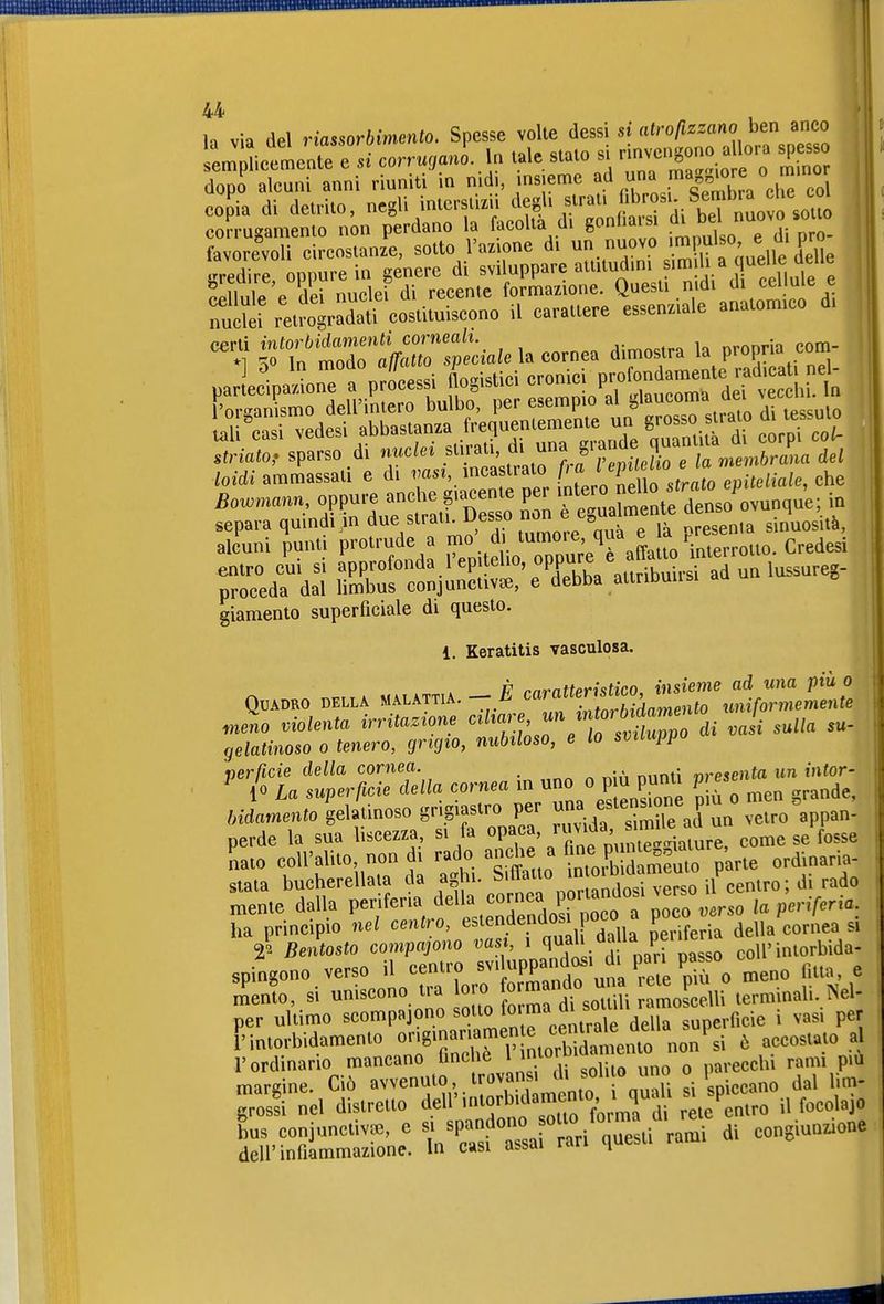 la via del riassorbimento. Spesse volte dessi si atrofizzano ben anco L ncemente e si corru.anl tale stato s. rmven^ono a ora si^3 s dopo alcuni anni riuniti in nidi, insieme ^'!' ^^IJ^'^fT'J'J^Zx copia di detrito, negli intcrstizii degli strati fibrosi. Sembra ch^ corrugamento non perdano la facoltà di gonfiarsi di bel O^« ^ ore'voT circostanzi sotto l'azione di S'^uueUe d^ predire oppure in genere di sviluppare attitudini s'm}l\a ^^^^^^^^^ Klp p Sei nuclei di recente formazione. Questi nidi di cellule e rùil^r retfo^dat costituiscono il carattere essenziale anatomico di j^t'So'aVro'rpéa-a^elacorne dimostra la propria com- üriato, sparso di nucU^ .^^^^^^^'^^^^^^^ del /oidi ammassati e di ms», mca trato fl^'^'^^^^ epiteliale, che Bowmann, oppure anche giacente per '^^^'^J^ll.^^^^^^ in separa quindi> due strat. Desso e^gua men^ p^sen^'inuo^ità, alcuni punti protrude a mo d tumore qua e a entro cui si 'pP^ofonda l'epitelio oppure e aff^^^^^^^^ proceda dal limbus conjunctiv«, e debba attribuii si giamento superficiale di questo. i. Keratitis vasculosa. P rnrntteristico, insieme ad una più a Quadro della malattia, — h ^«^^^'/'^^ ^,,,fo uniformemente tneno violenta irritazione '^^^^LTe Ts^^^^ sulla su- gelatinoso o tenero, grigio, nubiloso, e lo sviluppo nerßcie della cornea. _ . „,e,|ta un intor- ^ 10 La superficie della cornea in uno opu punti p ese /.•damento gelatinoso grigiastro per y^—^ perde la sua liscezza, si fa ^P^^a, ruvida i^^^^^^^^^^ come se fosse nato coU'alito, non di rado anche a ^'^^P ^'^^^'^^^^^ ordinaria- stata bucherellata da aghi. S'ffaUo in rado mente dalla periferia della cornea pò tandosi ^erso ha principio nel centro, estendendosi poco a P0C0J.f;«^^^,/,,,iea si 2' Bentosto compagno vas , 1 ^t\^^^'Pf''Js^^ coli'intorbida- spingono verso il eentro uP£nda^> di l^^an P^^^^^ ^.^^^^ , LI, si uniscono tra oro ^^ m^^^^^^^^ terminali..Nel- per ultimo scompajono sotto to'™a u superficie i vasi per ['intorbidamento «;;f-SrT ntorb atn^^^^ ^ ^--^^.^^ l'ordinario mancano finché l imor parecchi rami pm margine. Ciò avvenuto, trovans. di soli o no « 1 u.^. grS nel distretto dell'itorb>dament^^ ^^^^l,-, bus conjunctiv», e «/^/P^f ^^J «ri que^ rami di congiunzione deir infiammazione. In casi assai lan i