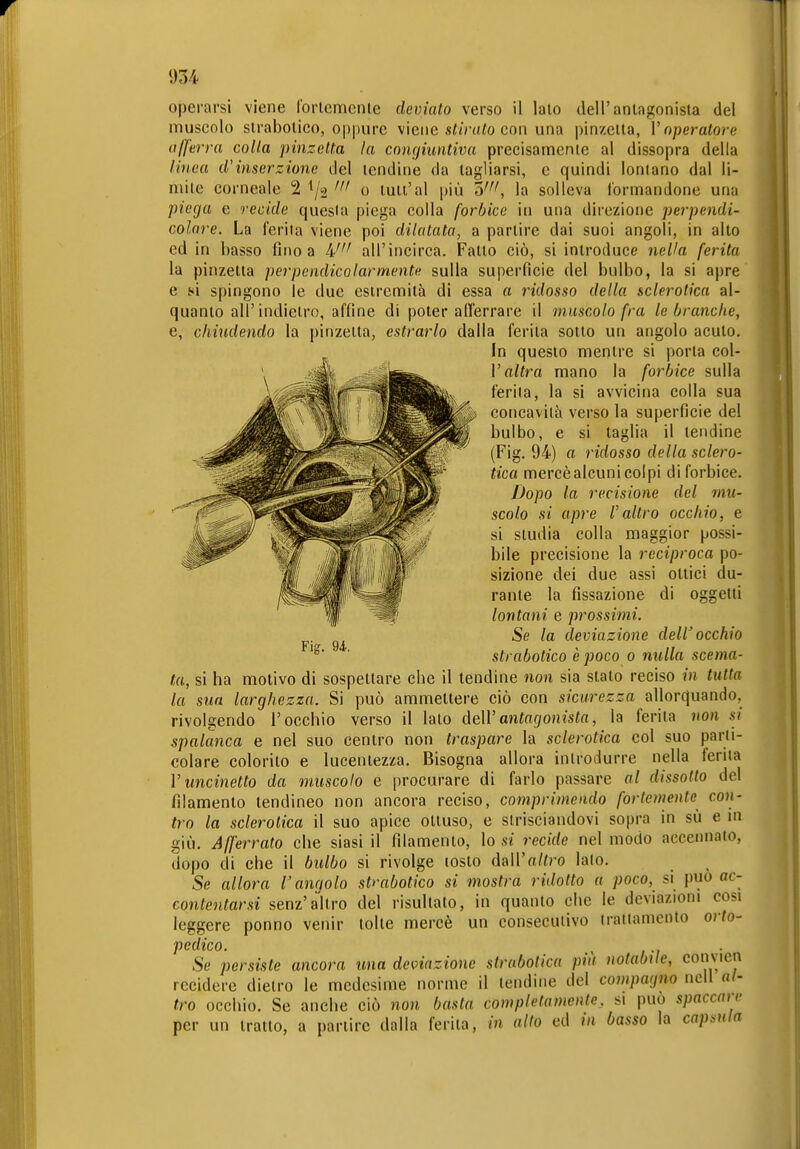 r 1! 934 operarsi viene Ibrlemenle devialo verso il lato dell'antagonista del muscolo slrabolico, oppure viene si<V«(o con una pinzetta, l'operatore aß'erra colla pinzetta la congiuntiva precisamente al dissopra della linea d'inserzione del tendine da tagliarsi, e quindi lontano dal li- mite corneale 2 ^/a o tuti'al più 5'^^ la solleva l'ormandone una piega e recide questa piega colla forbice in una direzione peiyendi- colare. La ferita viene poi dilatata, a partire dai suoi angoli, in alto ed in basso fino a 4'^' all'incirca. Fatto ciò, si introduce nella ferita la pinzetta perpendicolarmente sulla superficie del bulbo, la si apre e i^i spingono le due estremità di essa a ridosso della sclerotica al- quanto all'indietro, affine di poter afferrare il muscolo fra le branche, e, chiudendo la pinzetta, estrarlo dalla ferita sotto un angolo acuto. In questo mentre si porta col- V altra mano la forbice sulla ferita, la si avvicina colla sua concavilà verso la superficie del bulbo, e si taglia il tendine (Fig. 94) o ridosso della sclero- tica mercè alcuni colpi di forbice. Dopo la recisione del mu- scolo si apre l'altro occhio, e si studia colla maggior possi- bile precisione la reciproca po- sizione dei due assi ottici du- rante la fissazione di oggetti lontani e prossimi. Se la deviazione dell occhio slrabolico è poco o nulla scema- ta, si ha motivo di sospettare che il tendine non sia stato reciso in tutta la sua larghezza. Si può ammettere ciò con sicurezza allorquando, rivolgendo l'occhio verso il lato deWantagonista, la ferita non si spalanca e nel suo centro non traspare la sclerotica col suo parti- colare colorito e lucentezza. Bisogna allora introdurre nella ferita V uncinetto da muscolo e procurare di farlo passare al dissolto del filamento tendineo non ancora reciso, comprimendo forlementc con- tro la sclerotica il suo apice ottuso, e strisciandovi sopra in sù e in giù. Afferrato che siasi il filamento, lo si recide nel modo accennato, dopo di che il bulbo si rivolge tosto daWaltro lato. Se allora l'angolo slrabolico si mostra ridotto a poco, si può ac- contentarsi senz'altro del risultato, in quanto che le deviazioni cosi leggere ponno venir tolte mercè un consecutivo trattamento orto- pedico. Se persiste ancora una deviazione strabotica più notabile, convien recidere dietro le medesime norme il lendine del compagno nell «/- tro occhio. Se anche ciò non basta completamente, si può spaccare per un tratto, a partire dalla ferita, in alto ed in basso la capsula Fig. U.