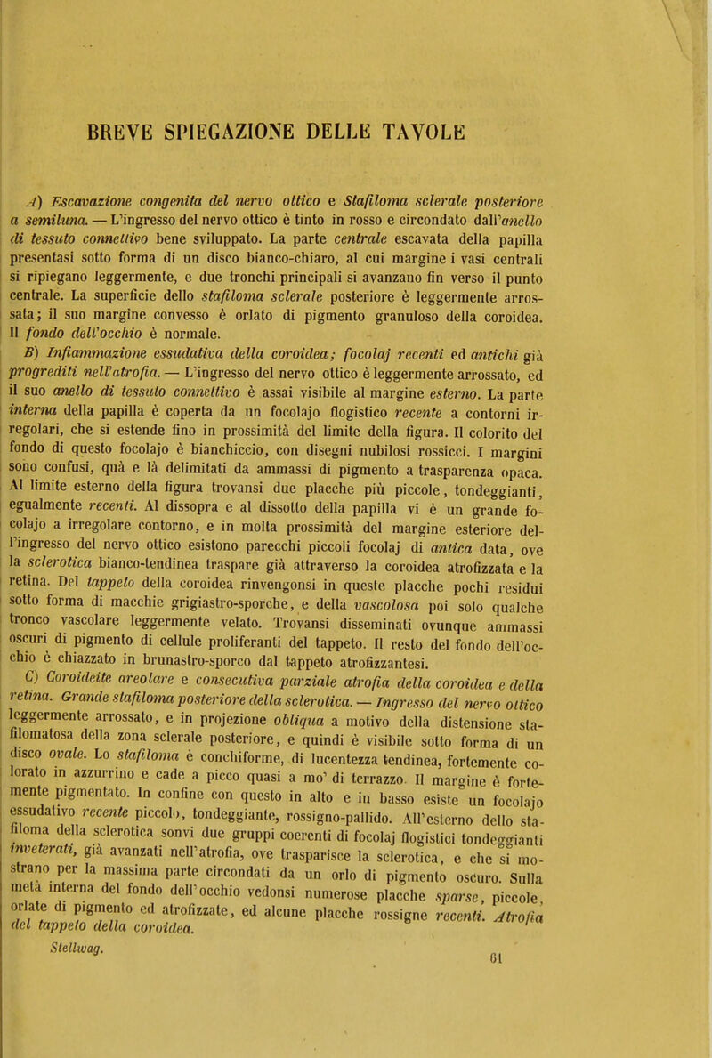 BREVE SPIEGAZIONE DELLE TAVOLE Escavazione congenita del nervo ottico e Stafiloma sclerale posteriore a semiluna. — L'ingresso del nervo ottico è tinto in rosso e circondato daìVanello di tessuto connettivo bene sviluppato. La parte centrale escavata della papilla presentasi sotto forma di un disco bianco-chiaro, al cui margine i vasi centrali si ripiegano leggermente, c due tronchi principali si avanzano fin verso il punto centrale. La superficie dello stafiloma sclerale posteriore è leggermente arros- sata; il suo margine convesso è orlato di pigmento granuloso della coroidea, II fondo dell'occhio è normale. B) Infiammazione essudativa della coroidea; focolaj recenti ed antichi già. progrediti nell'atrofia. — L'ingresso del nervo ottico è leggermente arrossato, ed il suo anello di tessuto connettivo è assai visibile al margine esterno. La parte interna della papilla è coperta da un focolajo flogistico recente a contorni ir- regolari, che si estende fino in prossimità del limite della figura. Il colorito del fondo di questo focolajo è bianchiccio, con disegni nubilosi rossicci. I margini sono confusi, qua e là delimitati da ammassi di pigmento a trasparenza opaca. Al limite esterno della figura trovansi due placche più piccole, tondeggianti, egualmente recenti. Al dissopra e al dissotto della papilla vi è un grande fo- colajo a irregolare contorno, e in molla prossimità del margine esteriore del- l'ingresso del nervo ottico esistono parecchi piccoli focolaj di antica data, ove la sclerotica bianco-tendinea traspare già attraverso la coroidea atrofizzata e la retina. Del tappeto della coroidea rinvengonsi in queste placche pochi residui sotto forma di macchie grigiastro-sporche, e della vascolosa poi solo qualche tronco vascolare leggermente velato. Trovansi disseminati ovunque allunassi oscuri di pigmento di cellule proliferanti del tappeto. Il resto del fondo dell'oc- chio è chiazzato in brunastro-sporco dal tappeto atrofizzantesi. C) Coroideite areolare e consecutiva parziale atrofia della coroidea e della retina. Grande stafiloma posteriore della sclerotica. — Ingre.sso del nervo ottico leggermente arrossato, e in projezione obliqua a motivo della distensione sta- filomatosa della zona sclerale posteriore, e quindi è visibile sotto forma di un disco ovale. Lo stafiloma è conchiforme, di lucentezza tendinea, fortemente co- lorato in azzurrino e cade a picco quasi a mo' di terrazzo. Il margine è forte- mente pigmentato. In confine con questo in alto e in basso esiste un focolajo essudativo recente piccoli, tondeggiante, rossigno-pallido. All'esterno dello sta- filoma della sclerotica sonvi due gruppi coerenti di focolaj flogistici tondeggianti inveterati, g.à avanzati nell'atrofia, ove trasparisce la sclerotica, e che si mo- strano per la massima parte circondati da un orlo di pigmento oscuro. Sulla meta interna del fondo dell'occhio vcdonsi numerose placche sparse, piccole orlate di pigmento ed atrofizzate, ed alcune placche rossigne recenti. At,'ofia del tappeto della coroidea. ' Stellivag. 61