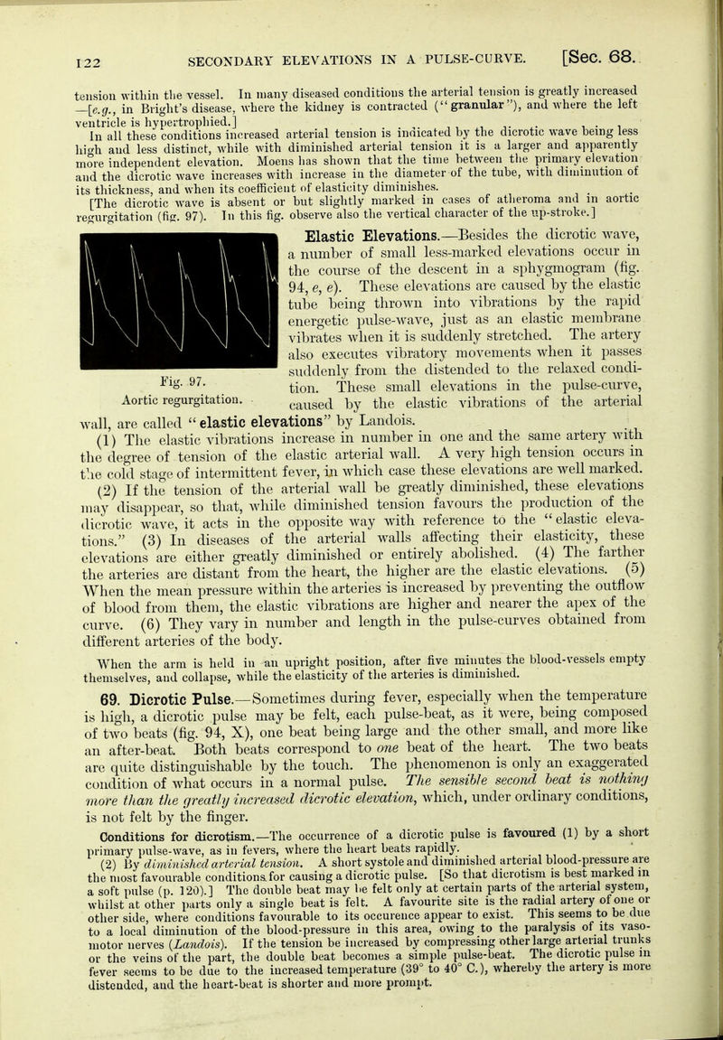 SECONDARY ELEVATIONS IN A PULSE-CURVE. [SeC. 68. tension within the vessel. In many diseased conditions the arterial tension is greatly increased —[e.g., in Bright's disease, where the kidney is contracted (granular), and where the left ventricle is hypertrophied.] , , , t ^. ^ • ^ In all these conditions increased arterial tension is innicated by the dicrotic wave being less hio-h and less distinct, while with diminished arterial tension it is a larger and apparently more independent elevation. Moens has shown that the time between the primary elevation and the dicrotic wave increases with increase in the diameter of the tube, with diminution of its thickness, and when its coefficient of elasticity diminishes. [The dicrotic w^ave is absent or but slightly marked in cases of atheroma and m aortic regurgitation (fig. 97). In this fig. observe also the vertical character of the up-stroke.] Elastic Elevations.—Besides the dicrotic wave, a number of small less-marked elevations occur in the course of the descent in a sphygmogram (fig. 94, e, e). These elevations are caused by the elastic tube being thrown into vibrations by the rapid energetic pulse-wave, just as an elastic membrane vibrates when it is suddenly stretched. The artery also executes vibratory movements when it passes suddenly from the distended to the relaxed condi- tion. These small elevations in the pulse-curve, Aortic regurgitation. caused by the elastic vibrations of the arterial wall, are called  elastic elevations by Landois. (1) The elastic vibrations increase in number in one and the same artery with the degree of tension of the elastic arterial wall. A very high tension occurs in the cold stage of intermittent fever, in which case these elevations are well marked. (2) If the tension of the arterial wall be greatly diminished, these elevations may disappear, so that, while diminished tension favours the production of the dicrotic wave, it acts in the opposite way with reference to the  elastic eleva- tions. (3) In diseases of the arterial walls affecting their elasticity, these elevations are either greatly diminished or entirely abolished. (4) The farther the arteries are distant from the heart, the higher are the elastic elevations. (5) When the mean pressure within the arteries is increased by preventing the outflow of blood from them, the elastic vibrations are higher and nearer the apex of the curve. (6) They vary in number and length in the pulse-curves obtained from different arteries of the body. When the arm is held in an upright position, after five minutes the blood-vesäels empty themselves, and collapse, while the elasticity of the arteries is diminished. 69. Dicrotic Pulse.—Sometimes during fever, especially when the temperature is high, a dicrotic pulse may be felt, each pulse-beat, as it Avere, being composed of two beats (fig. 94, X), one beat being large and the other small, and more like an after-beat. Both beats correspond to one beat of the heart. The two beats are quite distinguishable by the touch. The phenomenon is only an exaggerated condition of what occurs in a normal pulse. The sensible second beat is nothiwj more than the greatly increased dicrotic elevation, which, under ordinary conditions, is not felt by the finger. Conditions for dicrotism.—The occurrence of a dicrotic pulse is favoured (1) by a short primary pulse-wave, as in fevers, where the heart beats rapidly. , ,, , (2) By diminished arterial tension. A short systole and diminished arterial blood-pressure are the most favourable conditionafor causing a dicrotic pulse. [So that dicrotism is best marked in a soft pulse (p. 120).] The double beat may he felt only at certain parts of the arterial system, whilst at other parts only a single beat is felt. A favourite site is the radial artery of one or other side, where conditions favourable to its occurence appear to exist. This seems to be.due to a local diminution of the blood-pressure in this area, owing to the paralysis of its vaso- motor nerves {Landois). If the tension be increased by compressing other large arterial trunks or the veins of the part, the double beat becomes a simple pulse-beat. The dicrotic pulse m fever seems to be due to the increased temperature (39° to 40° C), whereby the artery is more distended, and the heart-beat is shorter and more prompt.