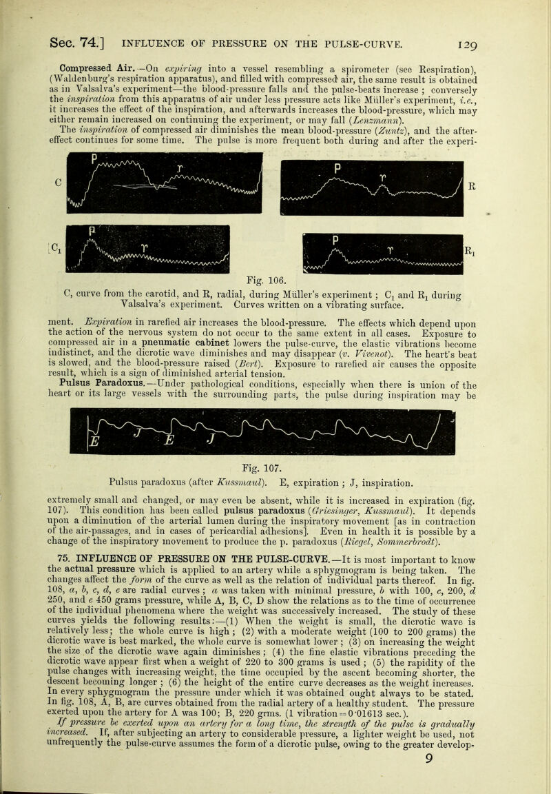 Sec. 74.] INFLUENCE OF PRESSURE ON THE PULSE-CURVE. Compressed Air. —Oa expiring into a vessel resembling a spirometer (see Respiration), (Waldenburg's respiration apparatus), and filled with compressed air, the same result is obtained as in Valsalva's experiment—the blood-pressure falls and the pulse-beats increase ; conversely the inspiration from this apparatus of air under less pressure acts like Miiller's experiment, i.e., it increases the effect of the inspiration, and afterwards increases the blood-pressure, which may either remain increased on continuing the experiment, or may fall {Lenzmann). The inspiration of compressed air diminishes the mean blood-pressure {Zuntz), and the after- effect continues for some time. The pulse is more frequent both during and after the experi- p I ' r ■ ■ / 1 Fig. 106. C, curve from the carotid, and E,, radial, during Miiller's experiment; and during Valsalva's experiment. Curves written on a vibrating surface. ment. _ Expiration in rarefied air increases the blood-pressure. The effects which depend upon the action of the nervous system do not occur to the same extent in all cases. Exposure to compressed air in a pneumatic cabinet lowers the pulse-curve, the elastic vibrations become indistinct, and the dicrotic wave diminishes and may disappear {v. Vivenot). The heart's beat is slowed, and the blood-pressure raised {Bert). Exposure to rarefied air causes the opposite result, Avhich is a sign of diminished arterial tension. Pulsus Paradoxus.—Under pathological conditions, especially when there is union of the heart or its large vessels with the surrounding parts, the pulse during inspiration may be Fig. 107. Pulsus paradoxus (after Kussmaul). E, expiration ; J, inspiration. extremely small and changed, or may even be absent, while it is increased in expiration (fig. 107). This condition has been called pulsus paradoxus {Griesinger, Kussmaul). It depends upon a diminution of the arterial lumen during the inspiratory movement [as in contraction of the air-passages, and in cases of pericardial adhesions]. Even in health it is possible by a change of the inspiratory movement to produce the p. paradoxus {Riegel, Sommei'hrodt). 75. INFLUENCE OF PKESSURE ON THE PULSE-CURVE. —It is most important to know the actual pressure which is applied to an artery while a sphygmogram is being taken. The changes affect the form of the curve as well as tlie relation of individual parts thereof. In fig. 108, a, b, c, d, e are radial curves ; a was taken with minimal pressure, b with 100, e, 200, d 250, arid e 450 grams pressure, while A, B, C, D show the relations as to the time of occurrence of the individual phenomena where the weight was successively increased. The study of these curves yields the following results:—(1) When the weight is small, the dicrotic wave is relatively less; the whole curve is high; (2) with a moderate weight (100 to 200 grams) the dicrotic wave is best marked, the whole curve is somewhat lower ; (3) on increasing the weight the size of the dicrotic wave again diminishes ; (4) the fine elastic vibrations preceding the dicrotic wave appear first when a weight of 220 to 300 grams is used ; (5) the rapidity of the pulse changes with increasing weight, the time occupied by the ascent becoming shorter, the descent becoming longer ; (6) the height of the entire curve decreases as the weight increases. In every sphygmogram the pressure under which it was obtained ought always to be stated. In fig. 108, A, B, are curves obtained from the radial artery of a healthy student. The pressure exerted upon the artery for A was ]00; B, 220 grms. (1 vibration = 0-01613 sec). If pressure be exerted up)on an artery for a long time, the strength of the pulse is gradually increased. If, after subjecting an artery to considerable pressure, a lighter weight be used, not unfrequently the pulse-curve assumes the form of a dicrotic pulse, owing to the greater develop-