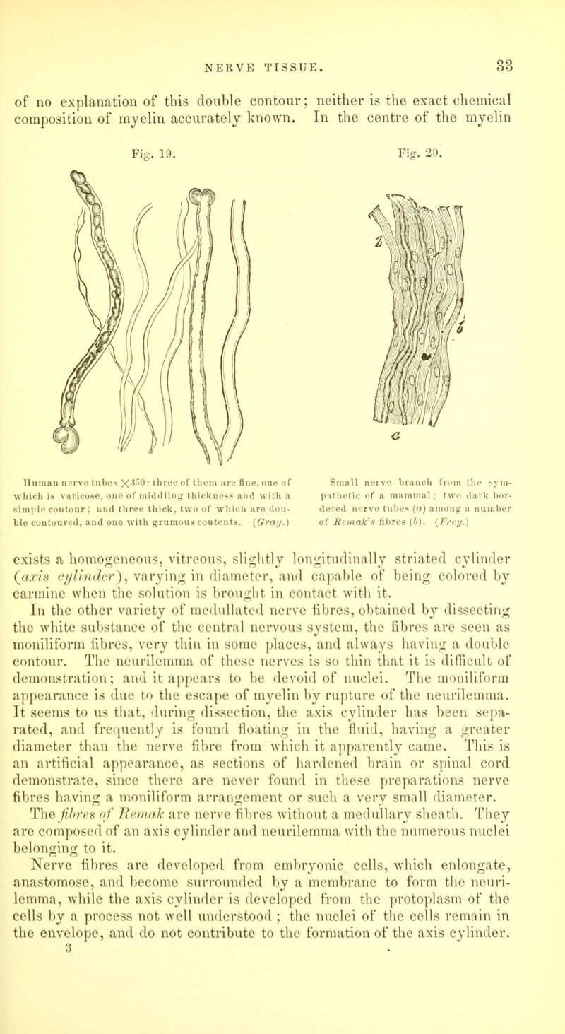 of no explanation of this double contour; neither is the exact chemical composition of myelin accurately known. In the centre of the myelin Fig. 19. Fig. 20. Human nerve tubes X-^°: three of them are fine, one of Small nerve branch from the sym- wllich is varicose, one of middling thickness and with a pathetic of a mammal: two dark bor- sirnple coutour ; and three thick, two of which are don- dered nerve tubes (a) among a number ble contoured, and one with gruraous contents. {Gray.) of Re male's fibres {b). (Frey.) exists a homogeneous, vitreous, slightly longitudinally striated cylinder (axis cylinder), varying in diameter, and capable of being colored by carmine when the solution is brought in contact with it. In the other variety of mednllated nerve fibres, obtained by dissecting the white substance of the central nervous system, the fibres are seen as moniliform fibres, very thin in some places, and always having a double contour. The neurilemma of these nerves is so thin that it is difficult of demonstration; and it appears to be devoid of nuclei. The moniliform appearance is due to the escape of myelin by rupture of the neurilemma. It seems to us that, during dissection, the axis cylinder has been sepa- rated, and frequently is found floating in the fluid, having a greater diameter than the nerve fibre from which it apparently came. This is an artificial appearance, as sections of hardened brain or spinal cord demonstrate, since there are never found in these preparations nerve fibres having a moniliform arrangement or such a very small diameter. The fibre* of Remah are nerve fibres without a medullary sheath. They are composed of an axis cylinder and neurilemma with the numerous nuclei belonging to it. Nerve fibres are developed from embryonic cells, which enlongate, anastomose, and become surrounded by a membrane to form the neuri- lemma, while the axis cylinder is developed from the protoplasm of the cells by a process not well understood ; the nuclei of the cells remain in the envelope, and do not contribute to the formation of the axis cylinder. 3