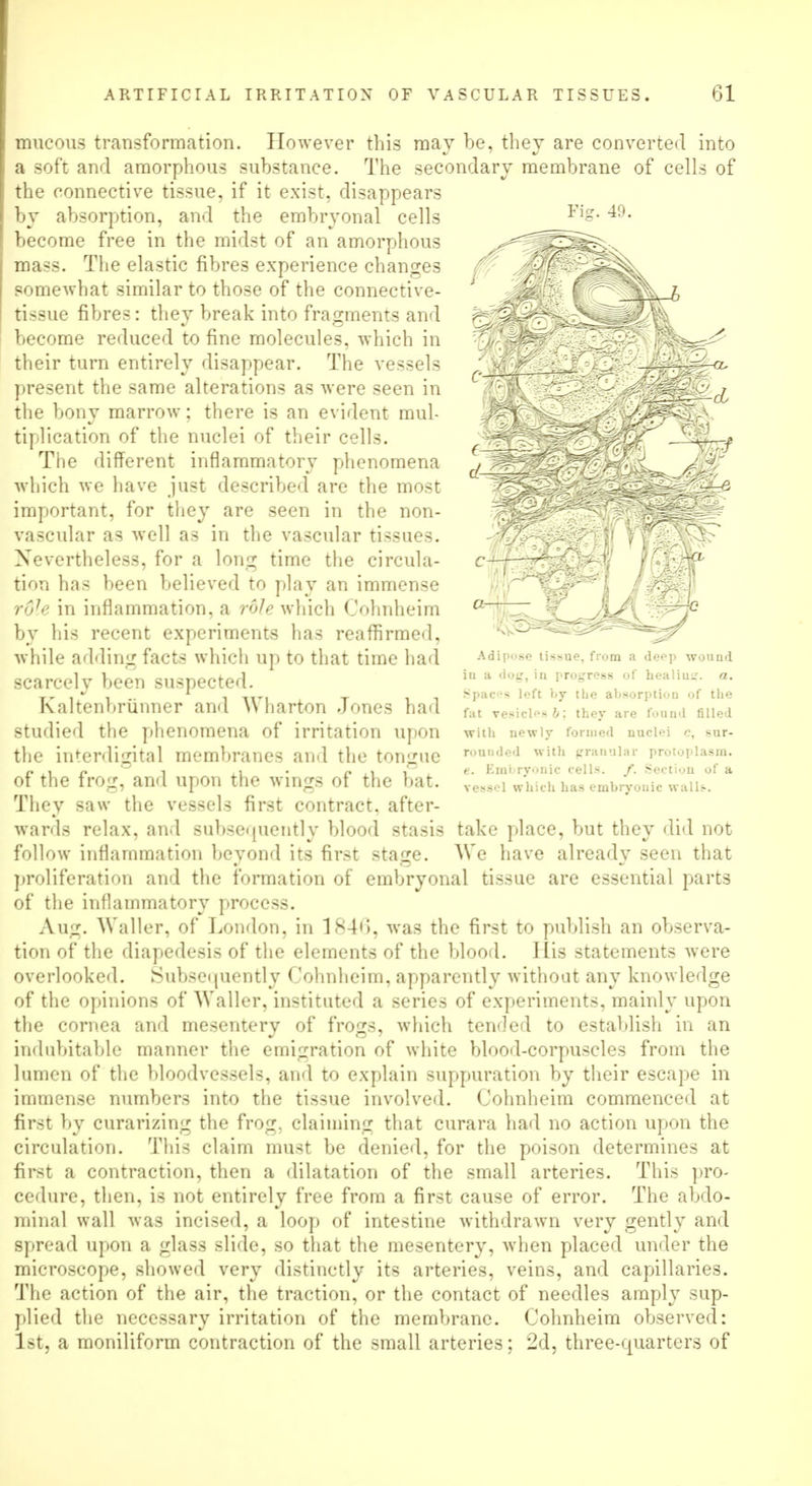mucous transformation. However this may be, they are converted into a soft and amorphous substance. The secondary membrane of cells of the connective tissue, if it exist, disappears by absorption, and the embryonal cells become free in the midst of an amorphous mass. The elastic fibres experience changes somewhat similar to those of the connective- tissue fibres: they break into fragments and become reduced to fine molecules, which in their turn entirely disappear. The vessels present the same alterations as were seen in the bony marrow; there is an evident mul- tiplication of the nuclei of their cells. The different inflammatory phenomena which we have just described are the most important, for they are seen in the non- vascular as well as in the vascular tissues. Nevertheless, for a long time the circula- tion has been believed to play an immense role in inflammation, a role which Cohnheim by his recent experiments has reaffirmed, while adding facts which up to that time had scarcely been suspected. Kaltenbriinner and Wharton Jones had studied the phenomena of irritation upon the interdigital membranes and the tongue of the frog, and upon the wings of the bat. They saw the vessels first contract, after- wards relax, and subsequently blood stasis take place, but they did not follow inflammation beyond its first stage. We have already seen that proliferation and the formation of embryonal tissue are essential parts of the inflammatory process. Aug. Waller, of London, in 1840, was the first to publish an observa- tion of the diapedesis of the elements of the blood. His statements were overlooked. Subsetjiiently Cohnheim, apparently without any knowledge of the opinions of Waller, instituted a series of experiments, mainly upon the cornea and mesentery of frogs, which tended to establish in an indubitable manner the emigration of white blood-corpuscles from the lumen of the bloodvessels, and to explain suppuration by their escape in immense numbers into the tissue involved. Cohnheim commenced at first by curarizing the frog, claiming that curara had no action upon the circulation. This claim must be denied, for the poison determines at first a contraction, then a dilatation of the small arteries. This pro- cedure, then, is not entirely free from a first cause of error. The abdo- minal wall was incised, a loop of intestine withdrawn very gently and spread upon a glass slide, so that the mesentery, when placed under the microscope, showed very distinctly its arteries, veins, and capillaries. The action of the air, the traction, or the contact of needles amply sup- plied the necessary irritation of the membrane. Cohnheim observed: 1st, a moniliform contraction of the small arteries; 2d, three-quarters of Adipi'se tissue, from a deep wound in a dog, in progress of healiu:.'. a. Spaces left by the absorption of the fat vesicles b; they are found filled with newly formed nuclei c, sur- rounded with granular protoplasm. e. Embryonic cells. /. Section of a vessel which has embryonic wall^.