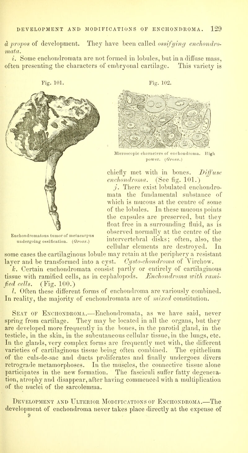 d propos of development. They have been called ossifying enchondro- mata. i. Some enchondromata are not formed in lobules, bat in a diffuse mass, often presenting the characters of embryonal cartilage. This variety is Fig. 101. Fi£?. 102. 1 :c^-z/c Wm Microscopic characters of en chondroma. High power. {Gross.) chiefly met with in bones. Diffuse enchondroma. (See fig. 101.) j. There exist lobulated enchondro- mata the fundamental substance of which is mucous at the centre of some of the lobules. In these mucous points the capsules are preserved, but they float free in a surrounding fluid, as is observed normally at the centre of the intervertebral disks; often, also, the cellular elements are destroyed. In some cases the cartilaginous lobule may retain at the periphery a resistant layer and be transformed into a cyst. Cysto-chondroma of Virchow. k. Certain enchondromata consist partly or entirely of cartilaginous tissue with ramified cells, as in cephalopods. Enchondroma with rami- fied cells. (Fig. 100.) I. Often these different forms of enchondroma are variously combined. In reality, the majority of enchondromata are of mixed constitution. Eucliondromatous tumor of metacarpus undergoing ossification. (Gross.) Seat of Enchondroma.—Enchondromata, as we have said, never spring from cartilage. They may be located in all the organs, but they are developed more frequently in the bones, in the parotid gland, in the testicle, in the skin, in the subcutaneous cellular tissue, in the lungs, etc. In the glands, very complex forms are frequently met with, the different varieties of cartilaginous tissue being often combined. The epithelium of the culs-de-sac and ducts proliferates and finally undergoes divers retrograde metamorphoses. In the muscles, the connective tissue alone participates in the new formation. The fasciculi suffer fatty degenera- tion, atrophy and disappear, after having commenced with a multiplication of the nuclei of the sarcolemma. Development and Ulterior Modifications of Enchondroma.—The development of enchondroma never takes place directly at the expense of 9