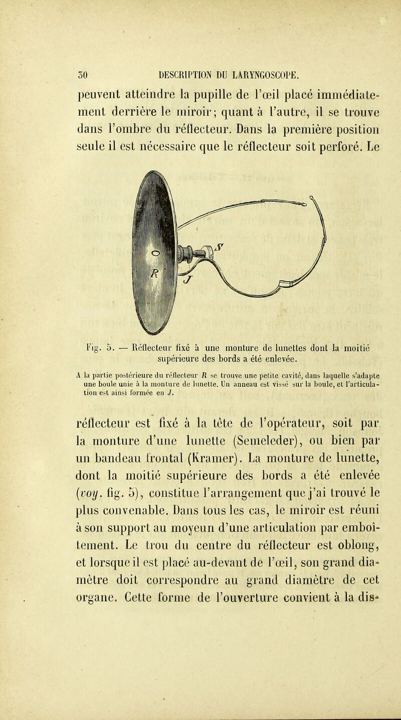 peuvent atteindre la pupille de l'œil placé immédiate- ment derrière le miroir; quant à l'autre, il se trouve dans l'ombre du réflecteur. Dans la première position seule il est nécessaire que le réflecteur soit perforé. Le Fig. 5. — Réilecteur fixé à une monture de lunettes dont la moitié supérieure des bords a été enlevée. A la partie postérieure du rôllecteur R se trouve une petite cavité, dans laquelle s'adapte une boule unie à la monture de lunette. Un anneau est vissé sur la boule, et l'articula- tion e?t ainsi formée en J. réflecteur est fixé à la tête de l'operateur, soit par la monture d'une lunette (Senielcder), ou bien par un bandeau Irontal (Kramer). La monture de lunette, dont la moitié supérieure des bords a été enlevée {voy. fig. 5), constitue l'arrangement que j'ai trouvé le plus convenable. Dans tous les cas, le miroir est réuni à son support au moyeun d'une articulation par emboî- tement. Le trou du centre du réflecteur est oblong, et lorsque il est placé au-devant de l'œil, son grand dia- mètre doit correspondre au grand diamètre de cet organe. Cette forme de l'ouverture convient à la dis'