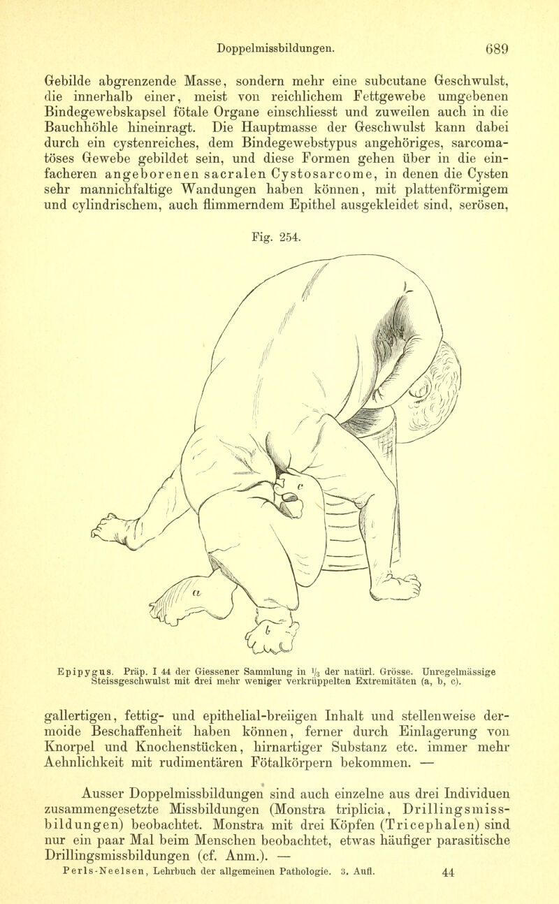 Gebilde abgrenzende Masse, sondern mehr eine subcutane Geschwulst, die innerhalb einer, meist von reichlichem Fettgewebe umgebenen Bindegewebskapsel fötale Organe einschliesst und zuweilen auch in die Bauchhöhle hineinragt. Die Hauptmasse der Geschwulst kann dabei durch ein cystenreiches, dem Bindegewebstypus angehöriges, sarcoma- töses Gewebe gebildet sein, und diese Formen gehen über in die ein- facheren angeborenen sacralen Cystosarcome, in denen die Cysten sehr mannichfaltige Wandungen haben können, mit plattenförmigem und cylindrischem, auch flimmerndem Epithel ausgekleidet sind, serösen. Fig. 254. Epipygus. Präp. I 44 der Giessener Sammlung in 1/3 der natürl. Grösse. Unregelmässige Steissgeschwulst mit drei mehr weniger verkrüppelten Extremitäten (a, b, c). gallertigen, fettig- und epithelial-breiigen Inhalt und stellenweise der- moide Beschaffenheit haben können, ferner durch Einlagerung von Knorpel und Xnochenstücken, hirnartiger Substanz etc. immer mehr Aehnlichkeit mit rudimentären Fötalkörpern bekommen. — Ausser Doppelmissbildungen sind auch einzelne aus drei Individuen zusammengesetzte Missbildungen (Monstra triplicia, Drillingsmiss- bildungen) beobachtet. Monstra mit drei Köpfen (Tricephalen) sind nur ein paar Mal beim Menschen beobachtet, etwas häufiger parasitische Drillingsmissbildungen (cf. Anm.). — Perls-Neelsen, Lehrbuch der allgemeinen Pathologie, 3. Aufl. 44