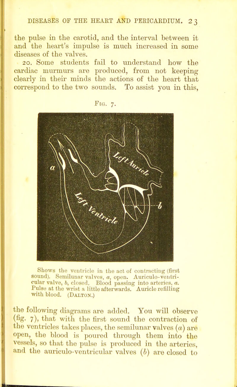 the pulse in the carotid, and the interval between it and the heart's impulse is much increased in some diseases of the valves. 20. Some students fail to understand how the cardiac murmurs are produced, from not keeping clearly in their minds the actions of the heart that correspond to the two sounds. To assist you in this, Fig. 7. Shows the ventricle in the act of contracting (first sound). Semilunar valves, a, open. Auriculo-ventri- cular valve, 6, closed. Blood passing into arteries, a. Pulse at the wrist a little afterwards. Auricle refilling with blood. (Dai/ton.) the following diagrams are added. You will observe (ng- 7); that with the hrst sound the contraction of the ventricles takes places, the semilunar valves (a) are open, the blood is poured through them into the vessels, so that the pulse is produced in the arteries, and the auriculo-ventricular valves (b) are closed to