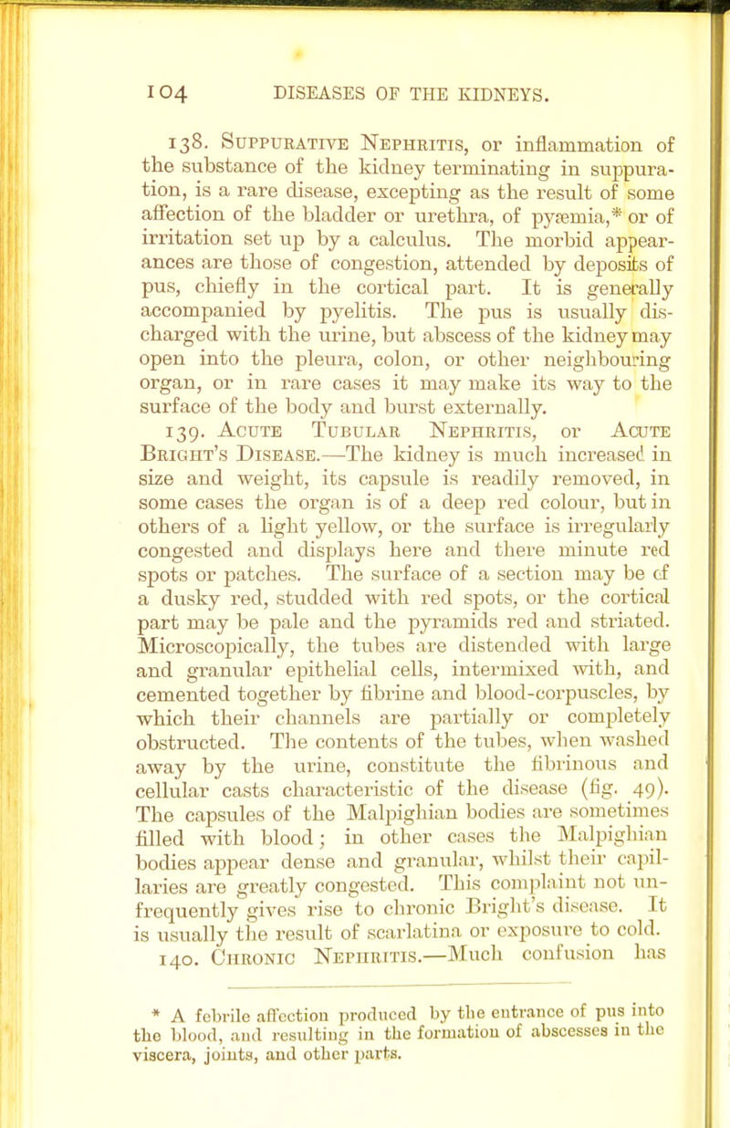 138. Suppurative Nephritis, or inflammation of the substance of the kidney terminating in suppura- tion, is a rare disease, excepting as the result of some affection of the bladder or urethra, of pyaemia,* or of irritation set up by a calculus. The morbid appear- ances are those of congestion, attended by deposits of pus, chiefly in the cortical part. It is generally accompanied by pyelitis. The pus is usually dis- charged with the urine, but abscess of the kidney may open into the pleura, colon, or other neighbouring organ, or in rare cases it may make its way to the surface of the body and burst externally. 139. Acute Tubular Nephritis, or Acute Bright's Disease.—The kidney is much increased in size and weight, its capsule is readily removed, in some cases the organ is of a deep red colour, but in others of a light yellow, or the surface is irregularly congested and displays here and there minute red spots or patches. The surface of a section may be of a dusky red, studded with red spots, or the cortical part may be pale and the pyramids red and striated. Microscopically, the tubes are distended with large and granular epithelial cells, intermixed with, and cemented together by fibrine and blood-corpuscles, by which their channels are partially or completely obstructed. The contents of the tubes, when washed away by the urine, constitute the fibrinous and cellular casts characteristic of the disease (fig. 49). The capsules of the Malpighian bodies are sometimes filled with blood; in other cases the Malpighian bodies appear dense and granular, whilst their capil- laries are greatly congested. This complaint not un- frequently gives rise to chronic Bright's disease. It is usually the result of scarlatina or exposure to cold. 140. Chronic Nephritis.—Much confusion has * A febrile affection produced by the entrance of pus into the blood, and resulting in the formation of abscesses in the viscera, joints, and other parts.