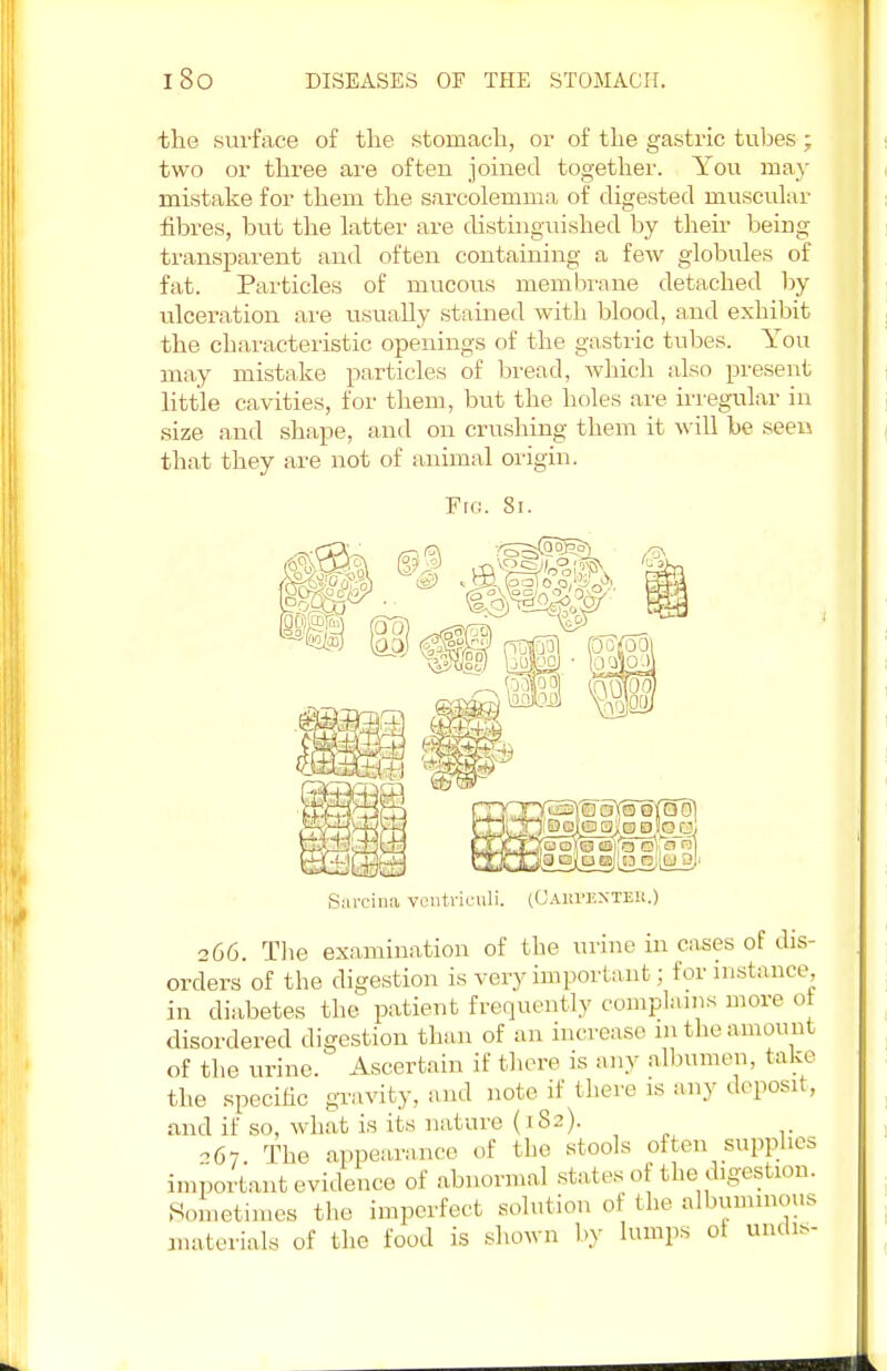 the surface of the stomach, or of the gastric tubes; two or three are often joined together. You may mistake for them the sarcolemma of digested muscular fibres, but the latter are distinguished by their being transparent and often containing a few globules of fat. Particles of mucous membrane detached by ulceration are usually stained with blood, and exhibit the characteristic openings of the gastric tubes. You may mistake particles of bread, which also present little cavities, for them, but the holes are irregular in size and shape, and on crushing them it will be seen that they are not of animal origin. Fro. 81. Sarcina ventnc (OAIU'EXTEK.) 266. The examination of the urine in cases of dis- orders of the digestion is very important; for instance, in diabetes the patient frequently complains more 0 disordered digestion than of an increase in the amount of the urine. Ascertain if then' is any albumen, take the specific gravity, and note if there is any deposit, and if so, what is its nature (182). -67 The appearance of the stools often supplies important evidence of abnormal states of the digestion. Sometimes the imperfect solution of the albuminous materials of the food is shown by lumps of undis-