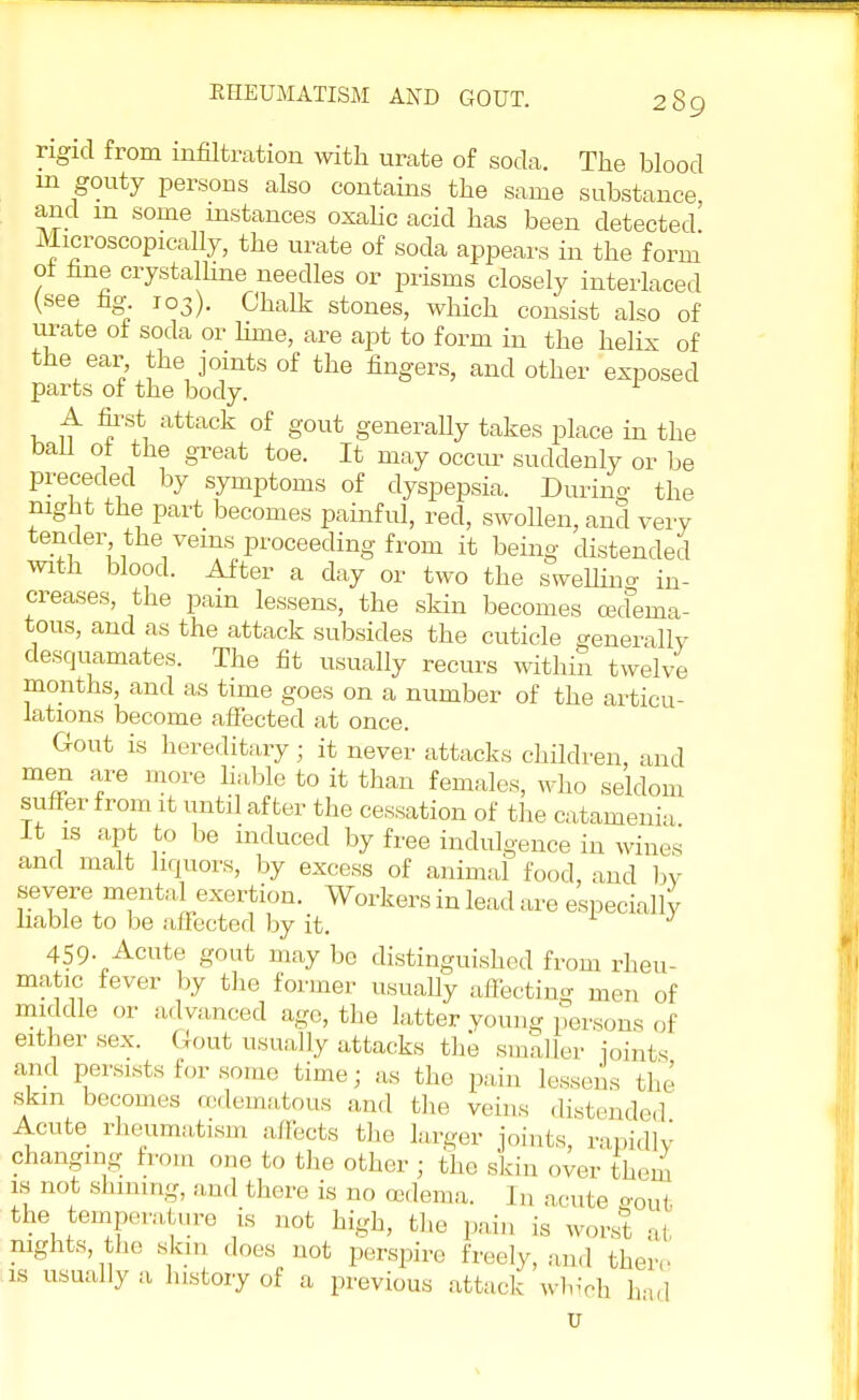 rigid from infiltration with urate of soda. The blood m gouty persons also contains the same substance, and in some instances oxalic acid has been detected Microscopically, the urate of soda appears in the form of fine crystalline needles or prisms closely interlaced (see fig 103). Chalk stones, which consist also of urate ot soda or lime, are apt to form in the helix of the ear the joints of the fingers, and other exposed parts of the body. r A first attack of gout generally takes place in the bail of the great toe. It may occur suddenly or be preceded by symptoms of dyspepsia. During the mght the part becomes painful, red, swollen, and very tender the veins proceeding from it being distended with blood. After a day or two the swelling in- creases, the pain lessens, the skin becomes cecfema- tous, and as the attack subsides the cuticle generally desquamates. The fit usually recurs within twelve months, and as time goes on a number of the articu- lations become affected at once. Gout is hereditary; it never attacks children, and men are more liable to it than females, who seldom suffer from it until after the cessation of the catamenia It is apt to be induced by free indulgence in wines' and malt liquors, by excess of animal food, and by severe mental exertion. Workers in lead are especially liable to be affected by it. 459- Acute gout may be distinguished from rheu- matic fever by the former usually affecting men of middle or advanced age, the latter young persons of either sex. Gout usually attacks the smaller Joints and persists for some time; as the pain lessens the skin becomes oedematous and the veins distended Acute rheumatism affects the larger joints, rapidlv changing from one to the other ; the skin over them is not shining, and there is no oedema. I „ acute gout the temperature is not high, the pain is worst at nights, the skin does not perspire freely, and there is usually a history of a previous attack which had u