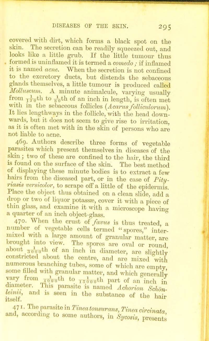 covered with dirt, which forms a black spot on the skin. The secretion can be readily squeezed out, and looks like a little grub. If the little tumour thus . formed is uninflamed it is termed a comedo ; if inflamed it is named acne. When the secretion is not confined to the excretory ducts, but distends the sebaceous glands themselves, a little tumour is produced called MoUusovm. A minute animalcule, varying usually from xfotn to -ijjth of an inch in length, is often met with in the sebaceous follicles (Acarusfolliculorum). It lies lengthways in the follicle, with the head down- wards, but it does not seem to give rise to irritation, as it is often met with in the skin of persons who are not liable to acne. 469. Authors describe three forms of vegetable parasites which present themselves in diseases of the skin; two of these are confined to the hair, the third is found on the surface of the skin. The best method of displaying these minute bodies is to extract a few hairs from the diseased part, or in the case of Pity- riasis versicolor, to scrape off a little of the epidermis. Place the object thus obtained on a clean slide, add a drop or two of liquor potassse, cover it with a piece of thin glass, and examine it with a microscope havino- a quarter of an inch object-glass. 470. When the crust of favus is thus treated, a number of vegetable cells termed spores, inter- mixed with a large amount of granular matter, are brought into view. The spores are oval or round, about -soVuth 01 an inch in diameter, are slightly' constricted about the centre, and are mixed with numerous branching tubes, some of which are empty some filled with granular matter, and which generally vary from T^th to r5-^th part of an inch in diameter. Tins parasite is named Achorion Schdn- lemit and is seen in the substance of the hair rtj36iX» 471. The parasite in Tinea tonsurans, Tinea circinata and, according to some authors, in Sycosis, presents