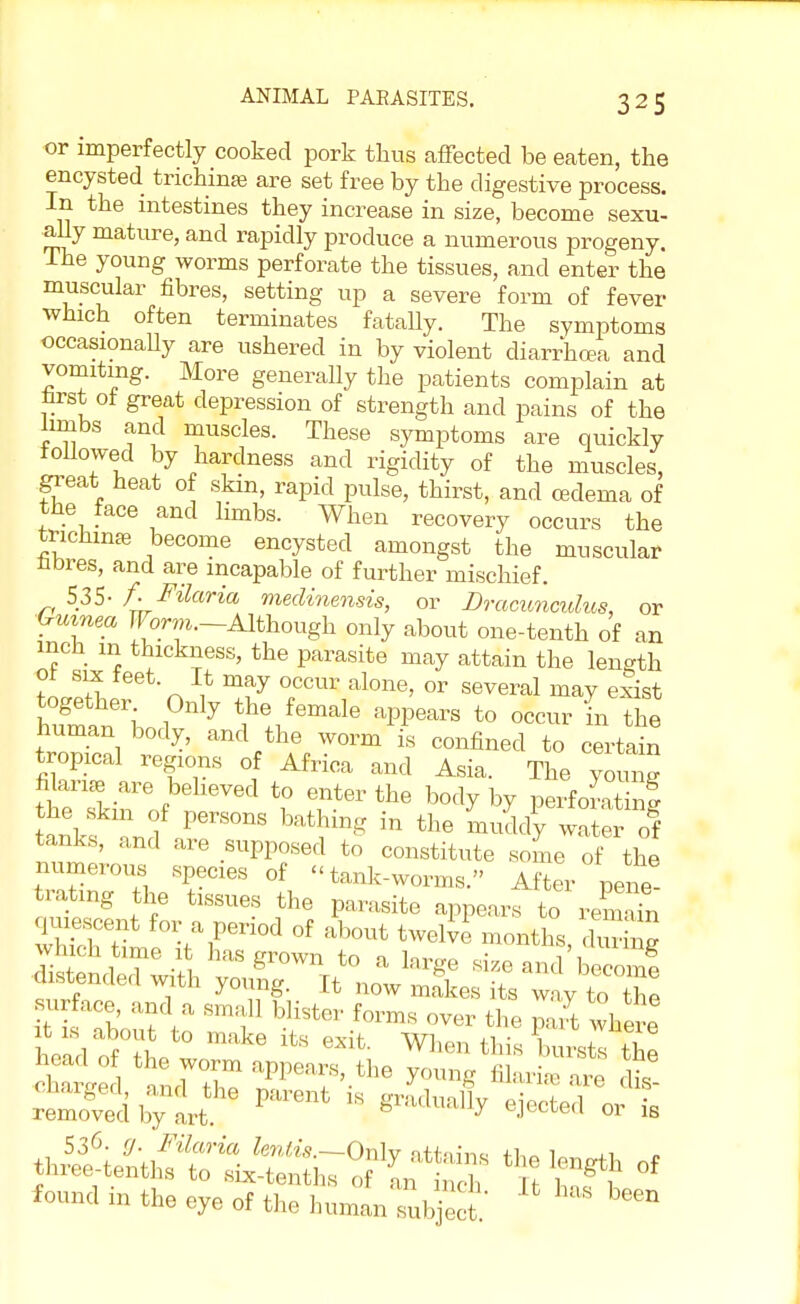 or imperfectly cooked pork thus affected be eaten, the encysted trichinae are set free by the digestive process. In the intestines they increase in size, become sexu- ally mature, and rapidly produce a numerous progeny. The young worms perforate the tissues, and enter the muscular fibres, setting up a severe form of fever which often terminates fatally. The symptoms occasionally are ushered in by violent diarrhoea and vomiting. More generally the patients complain at tost of great depression of strength and pains of the limbs and muscles. These symptoms are quickly followed by hardness and rigidity of the muscles, great heat of skin, rapid pulse, thirst, and cedeina of the face and limbs. When recovery occurs the fenchime become encysted amongst the muscular fibres, and are incapable of further mischief. 535- f. Filaria medinensis, or Dracunculus, or Guinea Worm.-Although only about one-tenth of an inch in thickness, the parasite may attain the length V r, * may °CCUr alone> or several may exist huSmaneri ^ ^J*™** V™ to occur in the human body, and the worm is confined to certain tropical regions of Africa and Asia. The young ttTkin% t0, Tterthe b0dyby PerfoSf Hnkf L f PerS°nS bat?mS in the muddy wter of tanks, and are supposed to constitute some of the numerous species of tank-worms. After pent rating the tissues the parasite appears to remain < e cent for a penod of about twelve months, duiW which time it has grown to a large size and becom! distended with young. It now makes its way to the surface and a small blister forms over the part where cWed andThT ^ ^ are &l removed' hjtrt* ^ * eieCted « * found m the eye of the human subject. ^