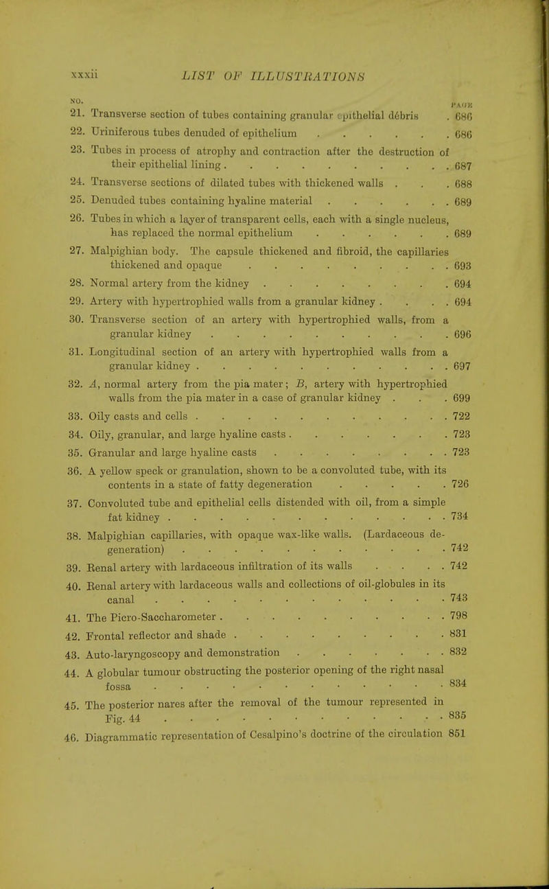 so. J'AIIK 21. Transverse section of tubes containing granular epithelial d6bris . 686 22. Uriniferous tubes denuded of epithelium 686 23. Tubes in process of atrophy and contraction after the destruction of their epithelial lining 687 24. Transverse sections of dilated tubes with thickened walls . . . 688 25. Denuded tubes containing hyaline material 689 26. Tubes in which a layer of transparent cells, each with a single nucleus, has replaced the normal epithelium . . . . . . 689 27. Malpighian body. The capsule thickened and fibroid, the capillaries thickened and opaque 693 28. Normal artery from the kidney 694 29. Artery with hypertrophied walls from a granular kidney . . . . 694 30. Transverse section of an artery with hypertrophied walls, from a granular kidney 696 31. Longitudinal section of an artery with hypertrophied walls from a granular kidney 697 32. A, normal artery from the pia mater; B, artery with hypertrophied walls from the pia mater in a case of granular kidney . . . 699 33. Oily casts and cells 722 34. Oily, granular, and large hyaline casts 723 35. Granular and large hyaline casts 723 36. A yellow speck or granulation, shown to be a convoluted tube, with its contents in a state of fatty degeneration 726 37. Convoluted tube and epithelial cells distended with oil, from a simple fat kidney , . . . 734 38. Malpighian capillaries, with opaque wax-like walls. (Lardaceous de- generation) 742 39. Eenal artery with lardaceous infiltration of its walls . . . . 742 40. Renal artery with lardaceous walls and collections of oil-globules in its canal 743 41. The Picro-Saccharometer 798 42. Frontal reflector and shade 831 43. Auto-laryngoscopy and demonstration 832 44. A globular tumour obstructing the posterior opening of the right nasal fossa 834 45. The posterior nares after the removal of the tumour represented in Fig. 44 .• • 835 46. Diagrammatic representation of Cesalpino's doctrine of the circulation 851