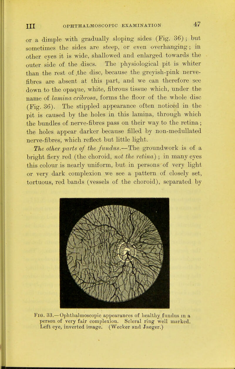 or a dimple witli gradually sloping sides (Fig. 36) ; but sometimes the sides are steep, or even overhanging ; in other eyes it is wide, shallowed and enlarged towards the outer side of the discs. The physiological pit is whiter than the rest of ,the disc, because the greyish-pink nerve- fibres are absent at this part, and we can therefore see down to the opaque, white, fibrous tissue which, under the name of lamina crihrosa, forms the floor of the whole disc (Fig. 36). The stippled appearance often noticed in the pit is caused by the holes in this lamina, through which the bundles of nerve-fibres pass on their way to the retina; the holes appear darker because filled by non-meduUated nei-ve-fibres, which reflect but little light. The other parts of the fundus.—The groundwork is of a bright fiery red (the choroid, not the retina) ; in many eyes this colour is nearly uniform, but in persons of very light or very dark complexion we see a pattern of closely set, tortuous, red bands (vessels of the choroid), separated by Fia. 33.— Ophthahnoscoi)ic appearances of healthy fundus m a person of very fair complexion. Scleral ring well marked. Left eye, inverted image. (Weeker and Jneger.)