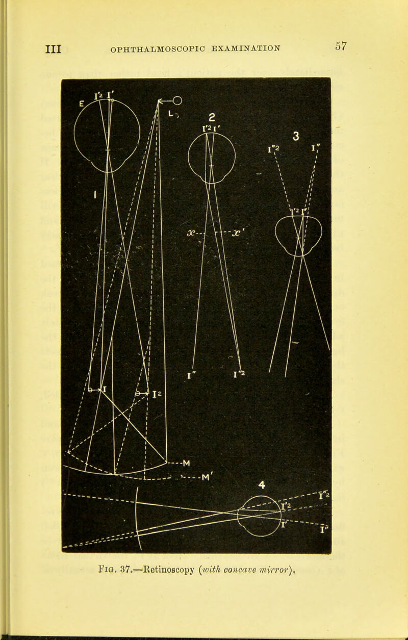 Fig, 37.—Ketinoscopy ^loith concave mirror).