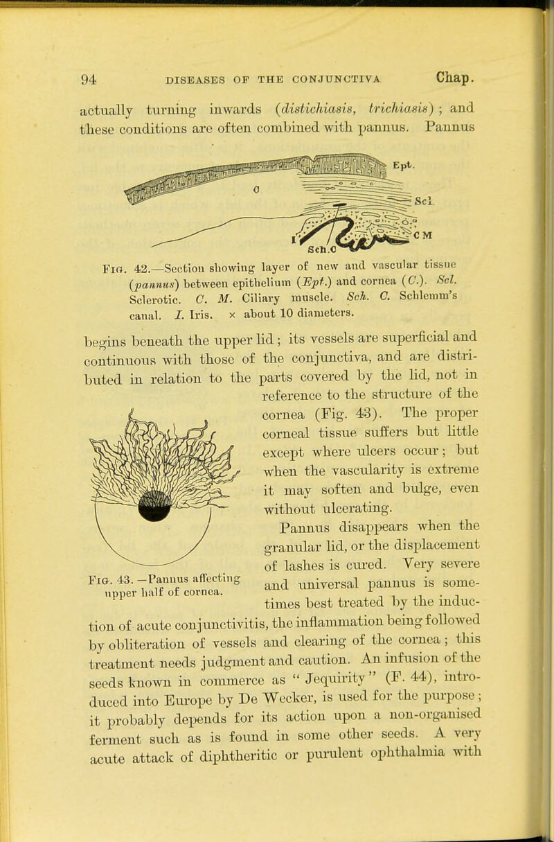 actually turning- inwards (distichiasis, trichiasis) ; and these conditions are often combined with pannus. Pannus Fio. 42.—Section showing layer of new and vascular tissue (pannus) between epithelium {Epf.) and cornea (C). Scl. Sclerotic. C. M. Ciliary muscle. Sch. C. Schlemm's canal. I. Iris, x about 10 diameters. hegins beneath the upper lid ; its vessels are superficial and continuous with those of the conjunctiva, and are distri- buted in relation to the parts covered by the hd, not in reference to the structure of the cornea (Fig. 43). The proper corneal tissue suffers but httle except where ulcers occur; but when the vascularity is exti-enie it may soften and bulge, even without ulcerating. Pannus disappears when the granular lid, or the displacement of lashes is ctu-ed. Very severe and universal pannus is some- times best treated by the induc- tion of acute conjunctivitis, the inflammation being followed by obliteration of vessels and clearing of the cornea; this treatment needs jiidgment and caution. An infusion of the seeds known in commerce as  Jequirity (F. 44), intro- duced into Europe by De Wecker, is used for the purpose; it probably depends for its action upon a non-organised ferment such as is found in some other seeds. A very acute attack of diphtheritic or pui-ulent ophthalmia with Fig. 43. —Pannus affecting upper half of cornea.