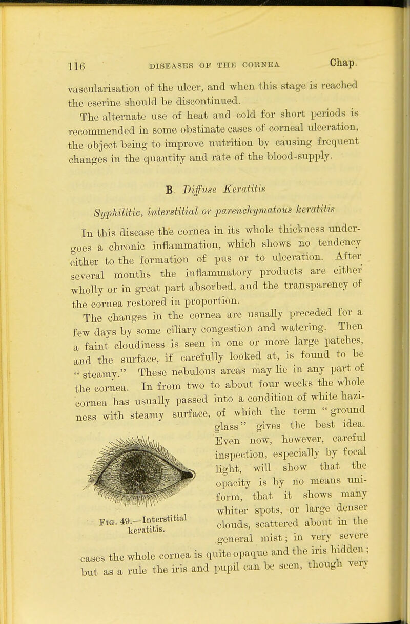 vascularisation of the ulcer, and when this stage is reached the eserine should be discontinued. The alternate use of heat and cold for short periods is recommended in some obstinate cases of corneal ulceration, the object being to improve nutrition by causing frequent changes in the quantity and rate of the blood-supply. B. Diffuse Keratitis SypliiVdic, interstitial or parenchyriiatous keratitis In this disease the cornea in its whole thickness under- goes a chronic inflammation, which shows no tendency either to the formation of pus or to ulceration. After several months the inflammatory products are either wholly or in great part absorbed, and the transparency of the cornea restored in proportion. The changes in the cornea are usually preceded for a few days by some ciliary congestion and watering. Then a faint cloudiness is seen in one or more large patches, and the surface, if carefully looked at, is found to be  steamy. These nebulous areas may lie in any part of the cornea. In from two to about four weeks the whole cornea has usually passed into a condition of white hazi- ness with steamy surface, of which the term  ground slass gives the best idea. Even now, however, careful inspection, especially by focal light, will show that the opacity is by no means uni- form, that it shows many whiter spots, or large denser ^'k^Str*'^'''^ clouds, scattered about in the general mist; in very severe cases the whole cornea is quite opaque and the iris hidden ; but as a rule the iris and pupil can be seen, though ver.