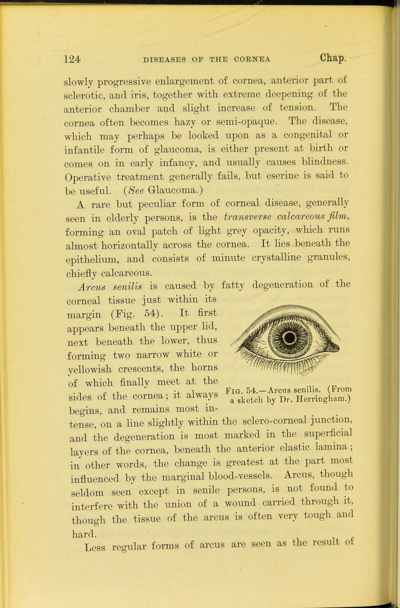 slowly progressive enlargement of cornea, anterior part of sclerotic, and iris, together with extreme deepening of the anterior chamber and slight increase of tension. The cornea often becomes hazy or semi-opaque. The disease, which may perhaps be looked upon as a congenital or infantile form of glaucoma, is either present at birth or comes on in early infancy, and usually causes blindness. Operative treatment generally fails, but eserine is said to be useful. (See Grlaucoma.) A rare but peculiar form of corneal disease, generally seen in elderly persons, is the transverse calcareous film., foi-ming an oval patch of light grey opacity, which runs almost horizontally across the cornea. It lies beneath the epithelium, and consists of minute crystalline granules, chiefly calcareotis. Arcus senilis is caused by fatty degeneration of the corneal tissue just within its margin (Fig. 54). It first appears beneath the upper lid, next beneath the lower, thus forming two narrow white or yellowish crescents, the horns of which finally meet at the sides of the cornea; it always begins, and remains most in- tense, on a line slightly within the sclero-corneal junction, and the degeneration is most marked in the superficial layers of the cornea, beneath the anterior elastic lamina; in other words, the change is greatest at the part most influenced by the marginal blood-vessels. Arcus, though seldom seen except in senile persons, is not found to interfere with the union of a wound carried through it, though the tissue of the arcus is often very tough and hard. i u * Less regular forms of arcus are seen as the result ot Fig. 54.—Ai'cus senilis. (From a sketch by Dr. Herringhara.)