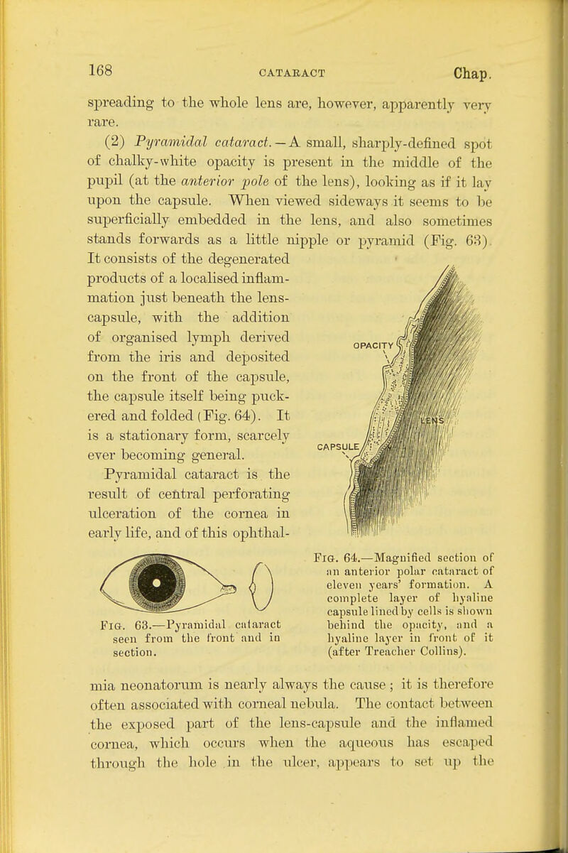 OPACITY spreading to the whole lens are, however, appai-ently very- rare. (2) Pyramidal cataract. —A small, sharply-defined spot of chalky-white opacity is present in the middle of the pupil (at the anterior pole of the lens), looking as if it lay upon the capsule. When viewed sideways it seems to be superficially embedded in the lens, and also sometimes stands forwards as a little nipple or pyramid (Fig. 68). It consists of the degenerated products of a localised inflam- mation just beneath the lens- capsule, with the addition of organised lymph derived from the iris and deposited on the front of the capsule, the capsule itself being puck- ered and folded (Fig. 64). It is a stationary form, scarcely ever becoming general. Pyramidal cataract is the result of central perforating ulceration of the cornea in early life, and of this ophthal- FiG. 64.—Maguified section of nil antei'ioi' polar cataract of eleven years' formation. A complete layer of liynliue capsule lined by cells is shown Fig. 63.—Pyramidal cn(aract behind the opacity, and a seen from the front and in hyaline layer in front of it section. (after Treacher Collins). CAPSULE mia neonatorum is nearly always the cause ; it is therefore often associated with corneal nebula. The contact between the exposed part of the lens-capsule and the inflamed cornea, which occurs when the aqueous has escaped through the hole in the ulcer, appears to set up the