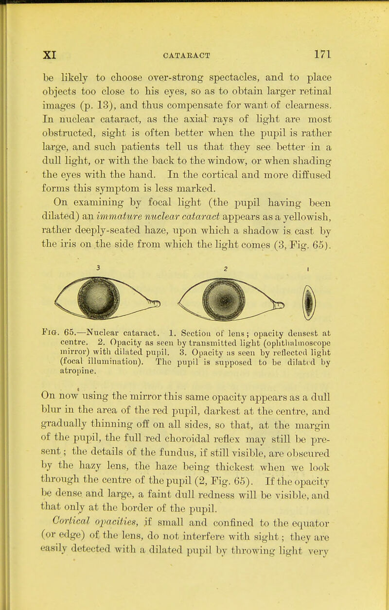 be likely to choose over-strong spectacles, and to place objects too close to liis eyes, so as to obtain larger retinal images (p. 13), and thus compensate for want of clearness. In nuclear cataract, as the axial rays of light are most obstructed, sight is often better when the pupil is rather large, and such patients tell us that they see better in a dull light, or with the back to the window, or when shading the eyes with the hand. In the cortical and more diffused forms this symptom is less marked. On examining by focal light (the pupil haying been dilated) an immature nuclear cataract appears as a yellowish, rather deeply-seated haze, upon which a shadow is cast by the iris on.the side from which the light comes (3, Fig. 65). Fia. 65.—Nuclear cataract. 1. Section of lens; opacity densest at centre. 2. Opacity as seen by transmitted light (oplitlinlmoscope mirror) with dilated pupil. 3. Opacity as seen by reflected light (focal illuminatiou). The pupil is supposed to be dilated by atropine. On now using the mirror this same opacity appears as a dull blur in the area of the red pupil, darkest at the centre, and gradually thinning off on all sides, so that, at the margin of the pupil, the full red choroidal reflex may still be pre- sent ; the details of the fundus, if still visible, are obscured by the hazy lens, the haze being thickest when we look through the centre of the pupil (2, Fig. 65). If the opacity be dense and large, a faint dull redness will be visible, and that only at the border of the pupil. Cortical oimcities, if small and confined to the equator (or edge) of the lens, do not interfere with sight; they are easily detected with a dilated pupil by throwing light very
